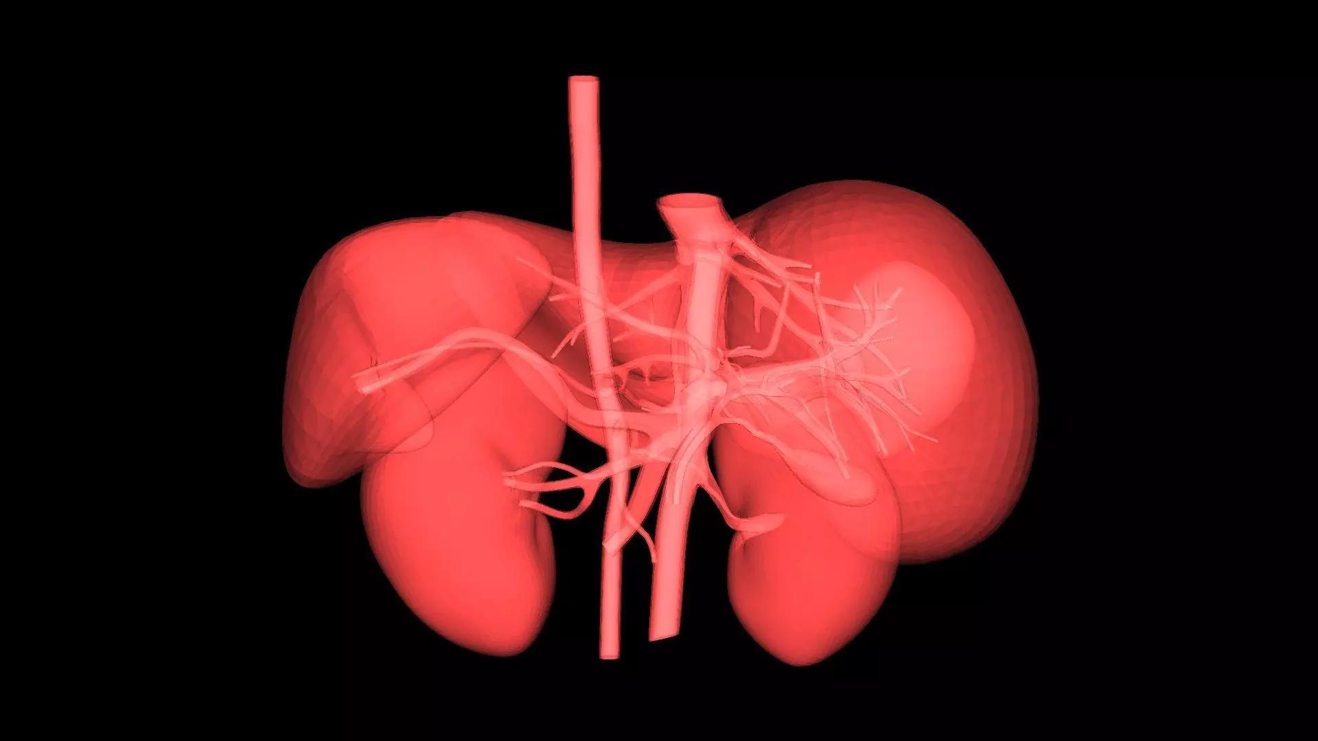 3D Model of Pre- and Post- Operative Liver 3D model_0