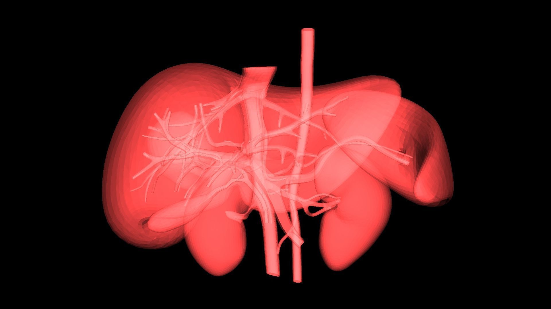 3D Model of Pre- and Post- Operative Liver 3D model_3