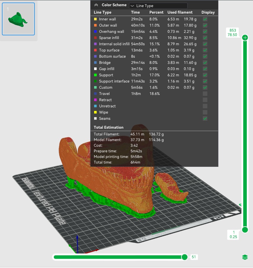 Venom Shadow Clone- Wearable in Hand - Marvel Comics 3D print model_33