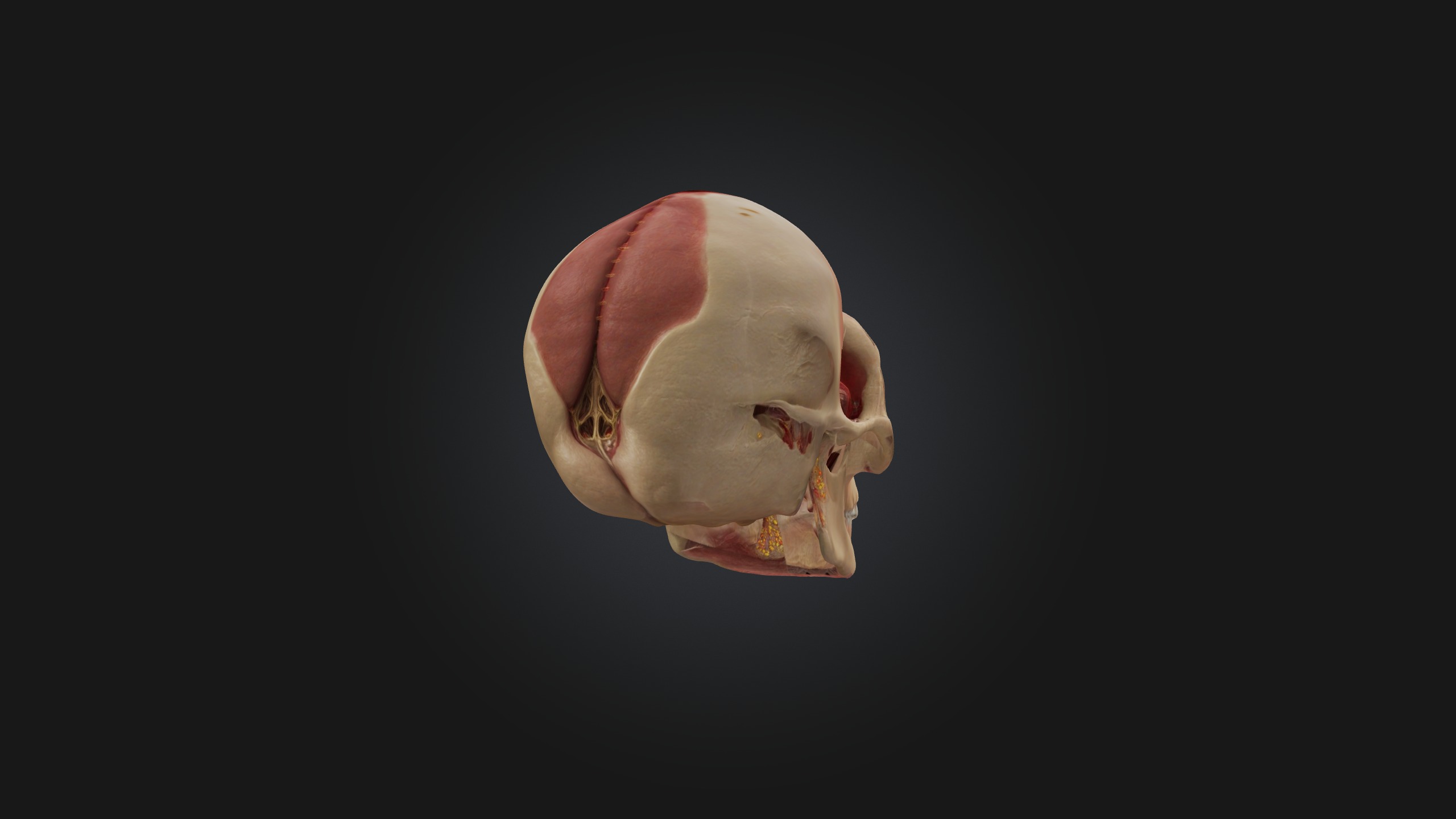 Infected Sinus Low-poly 3D model_7