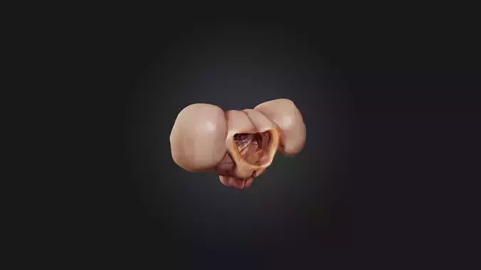 Infected Prostate Low-poly 3D model