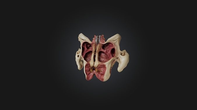 Infected Pelvis Low-poly 3D model
