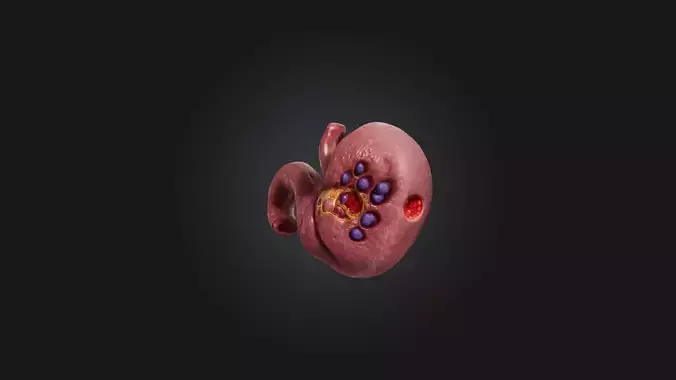 Infected Pancreas Low-poly 3D model
