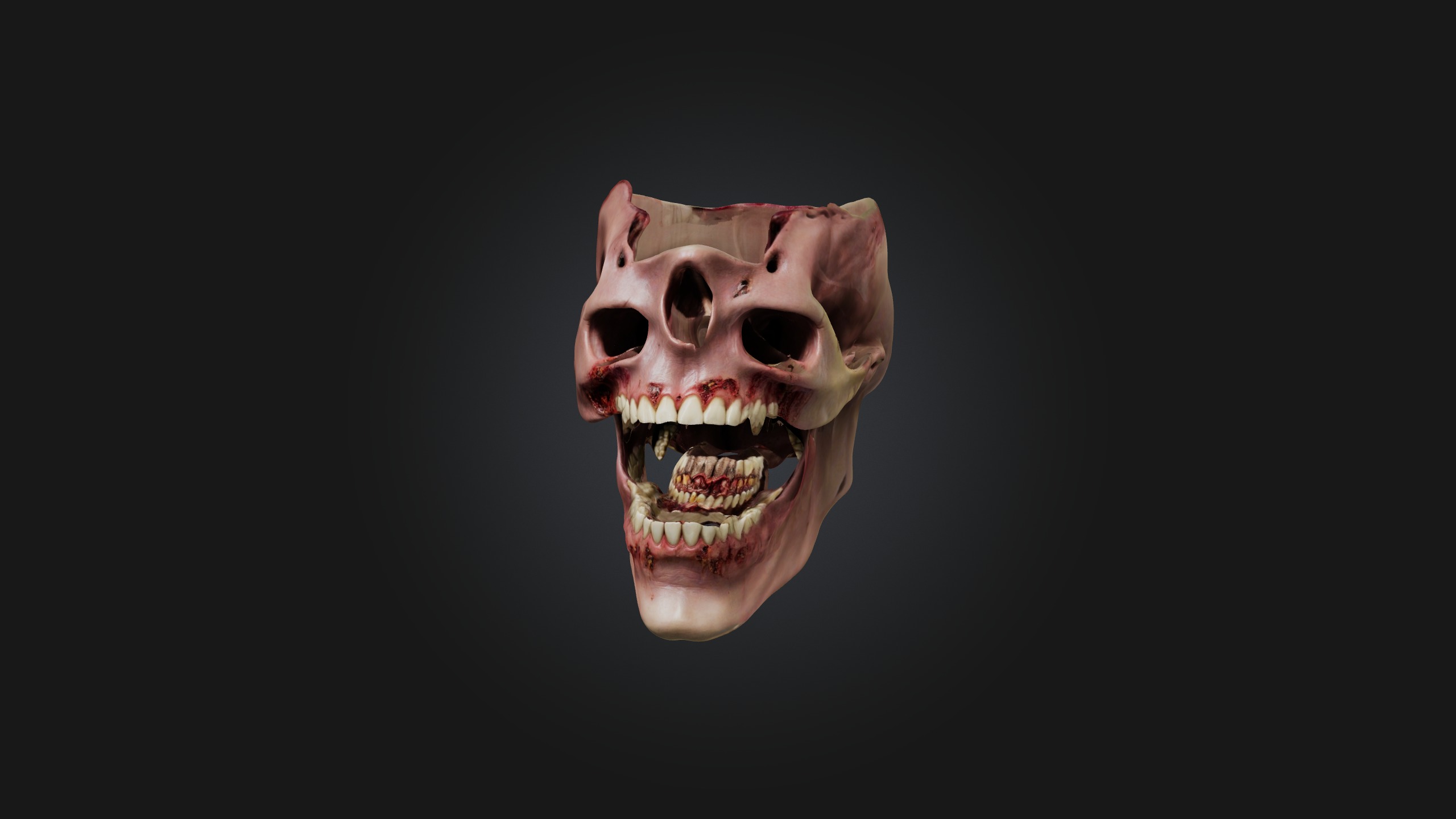 Infected Jaw Low-poly 3D model_5
