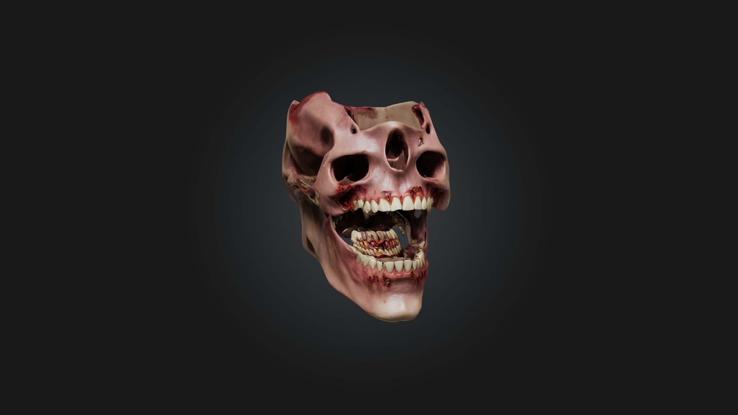 Infected Jaw Low-poly 3D model_2