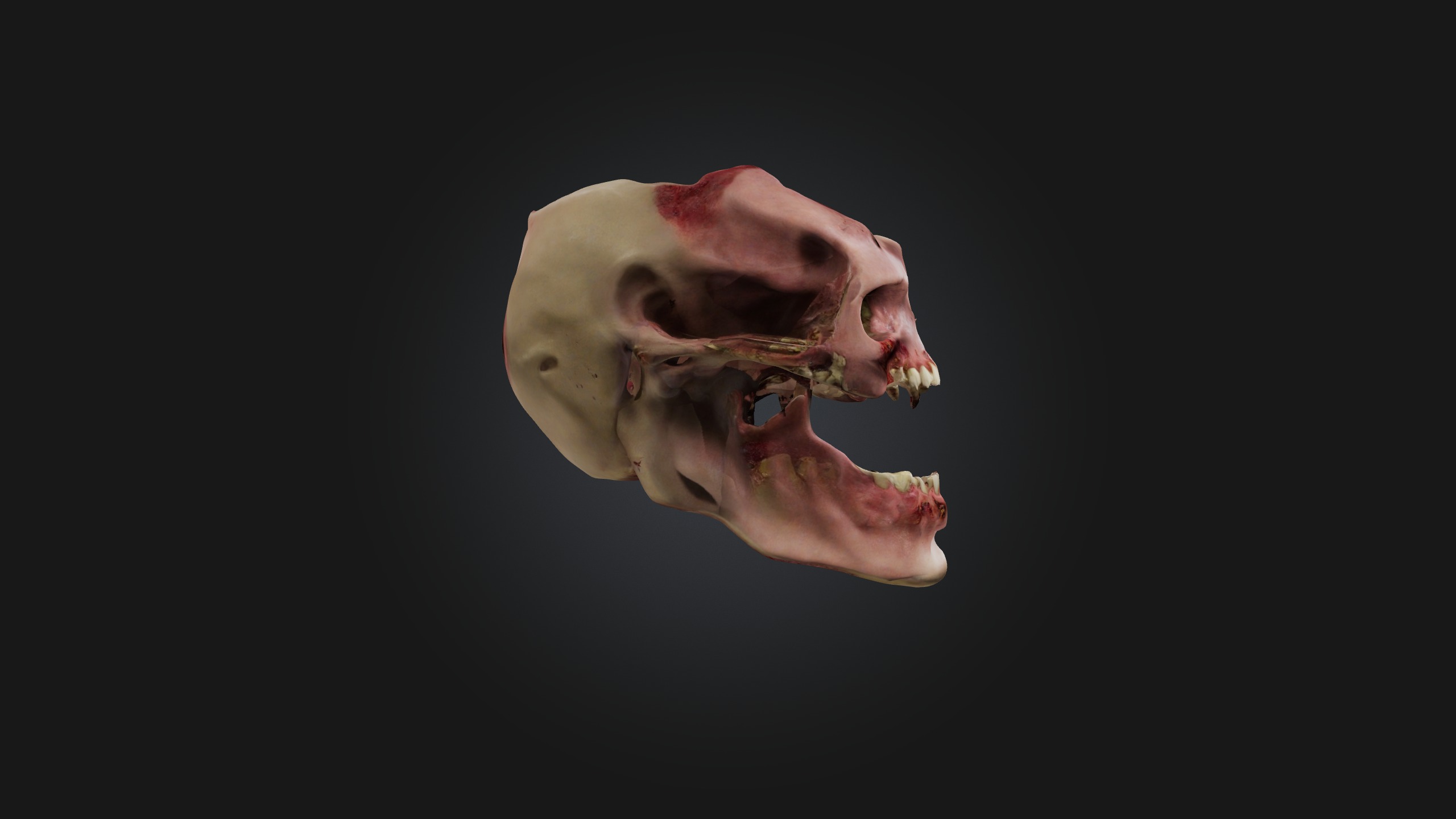 Infected Jaw Low-poly 3D model_3