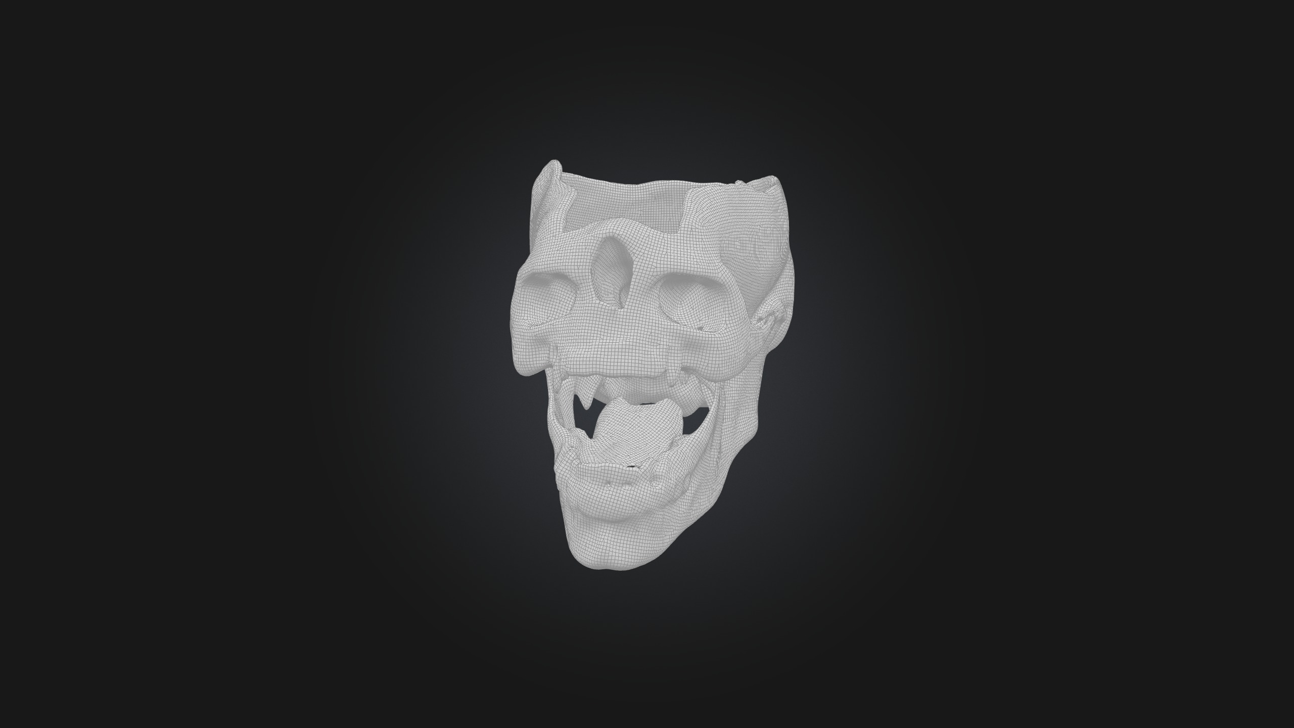 Infected Jaw Low-poly 3D model_1