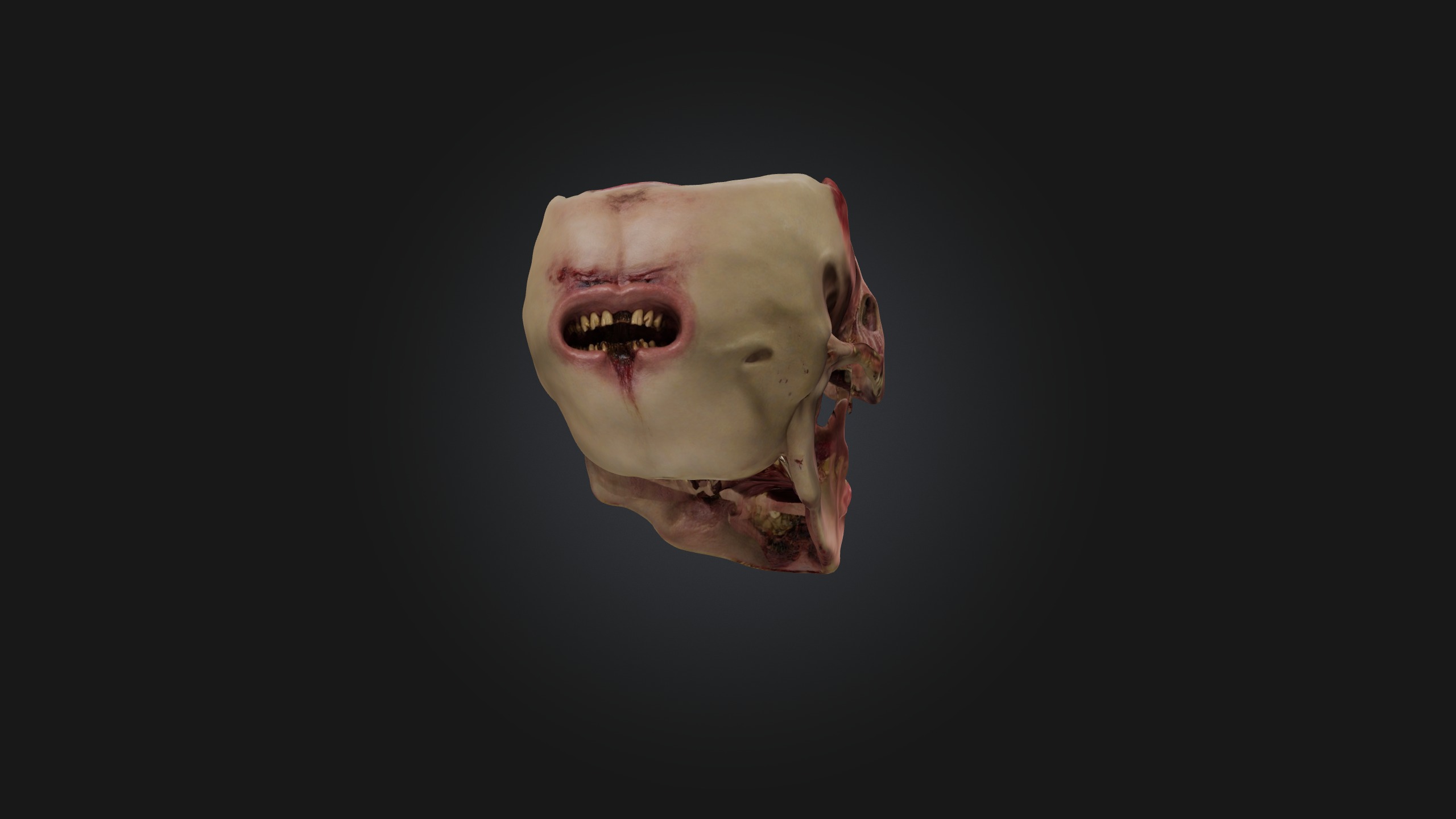 Infected Jaw Low-poly 3D model_4