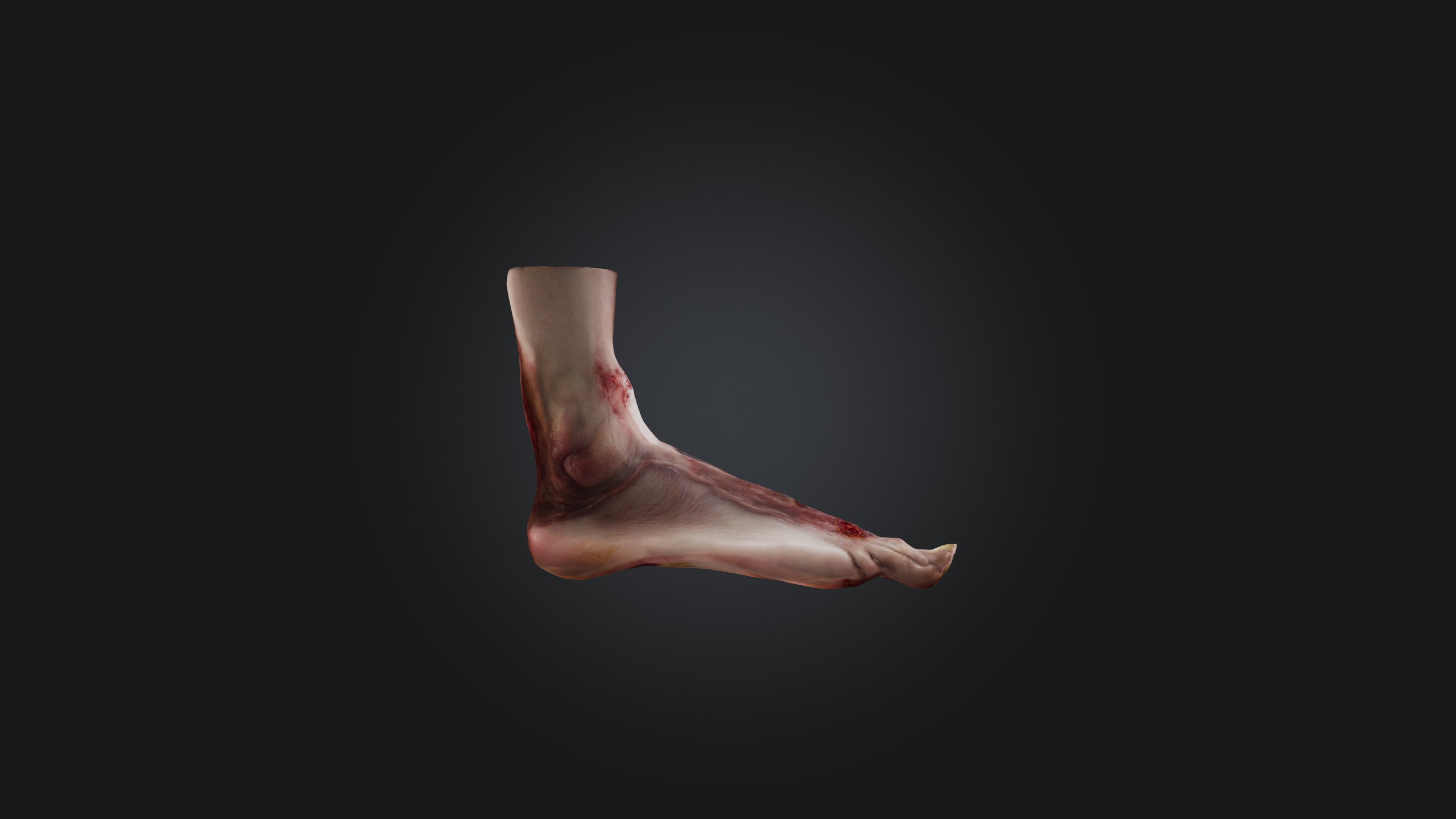 Infected Foot Low-poly 3D model_5