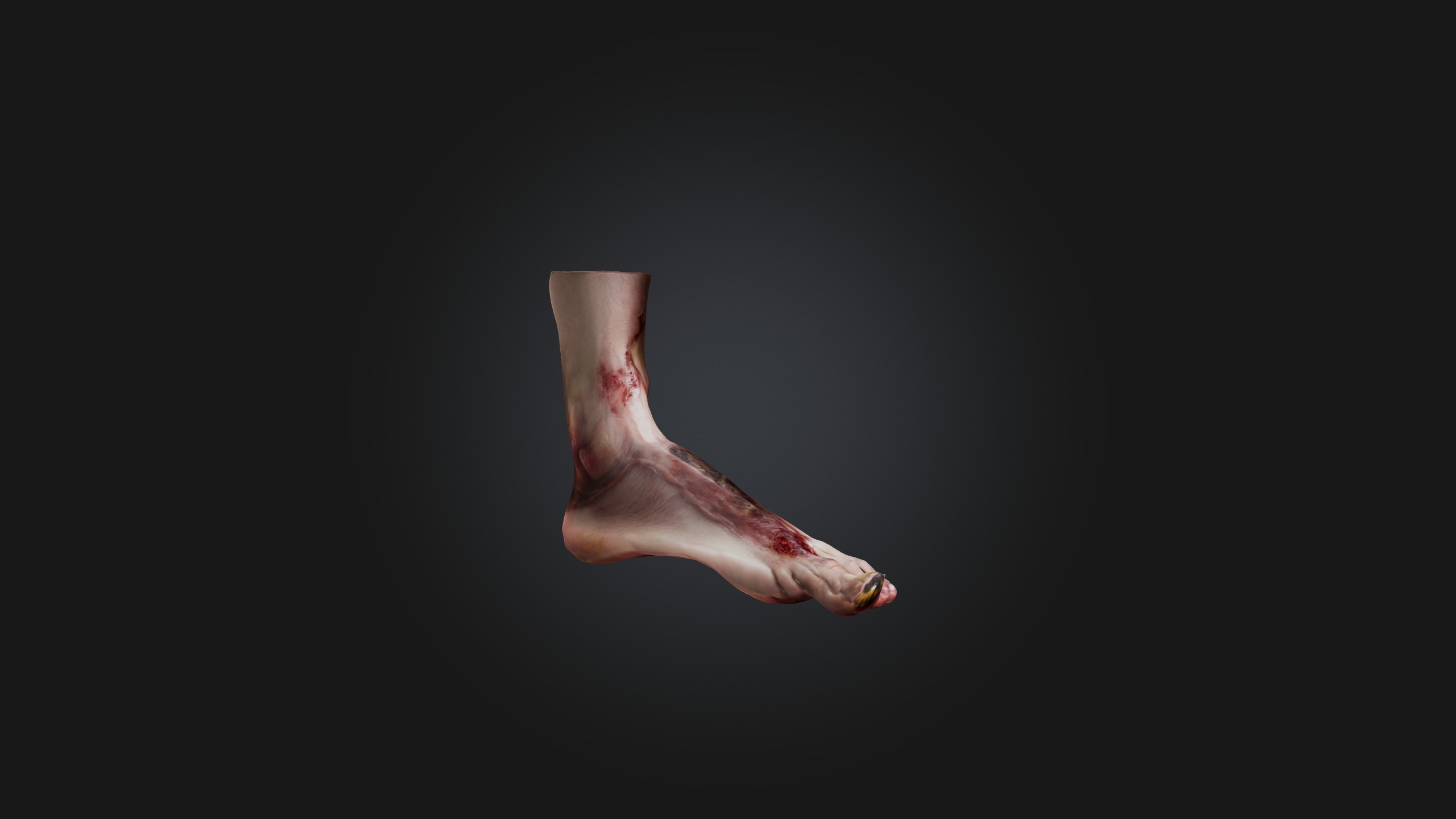 Infected Foot Low-poly 3D model_4