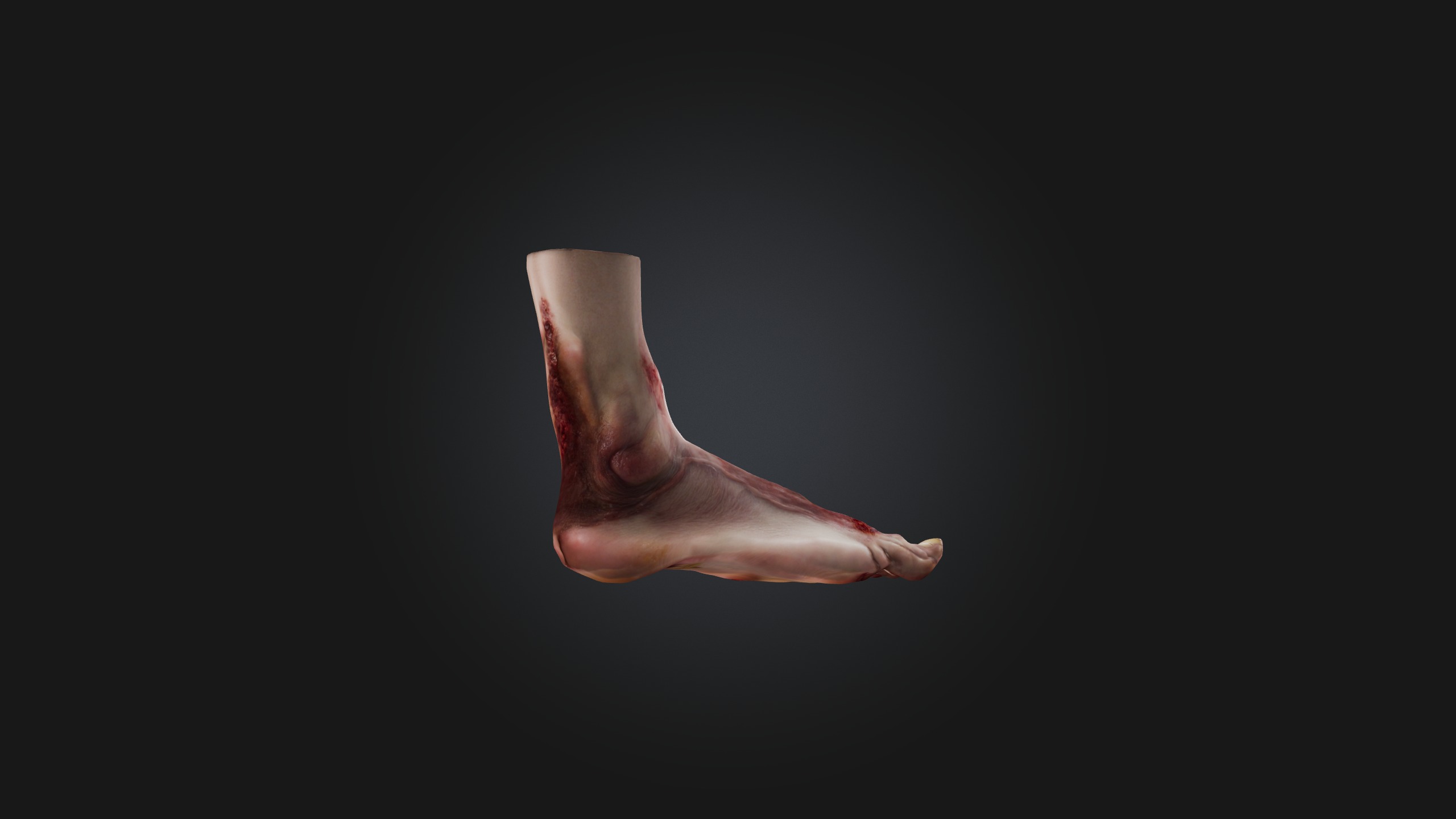 Infected Foot Low-poly 3D model_6