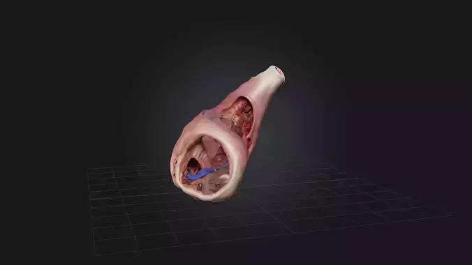 Infected Esophagus Low-poly 3D model