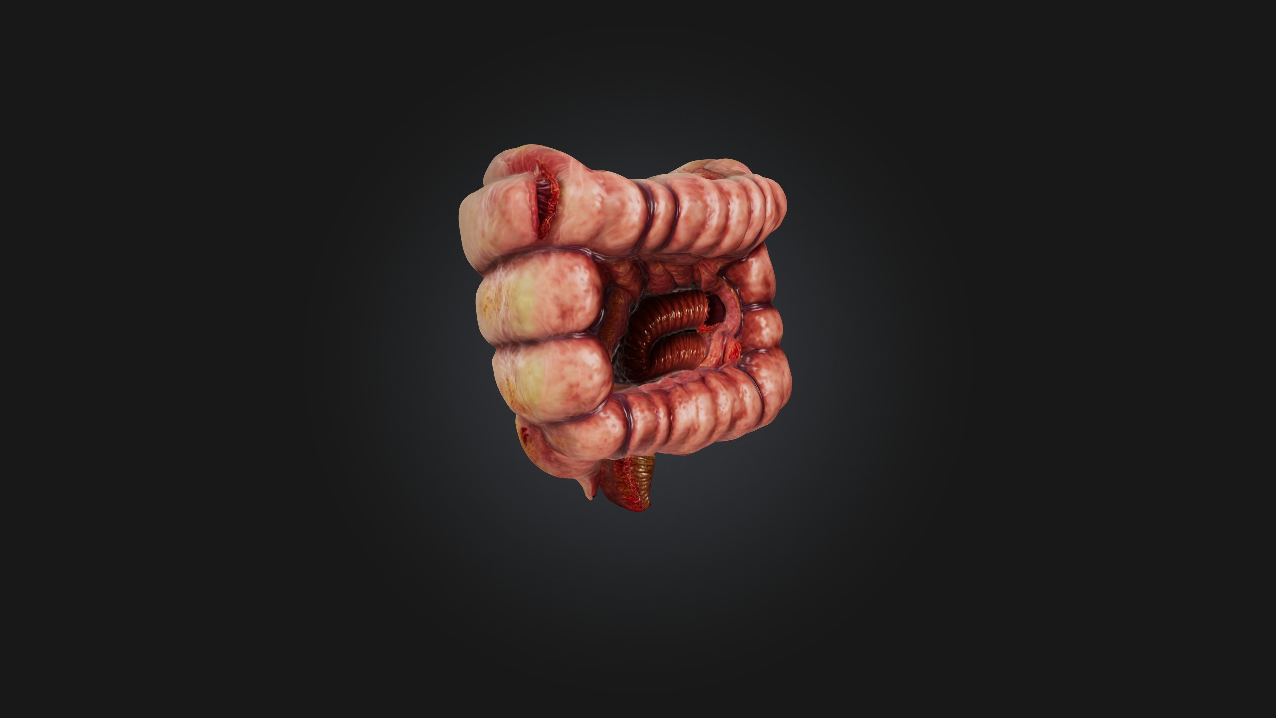 Infected Colon Low-poly 3D model_8
