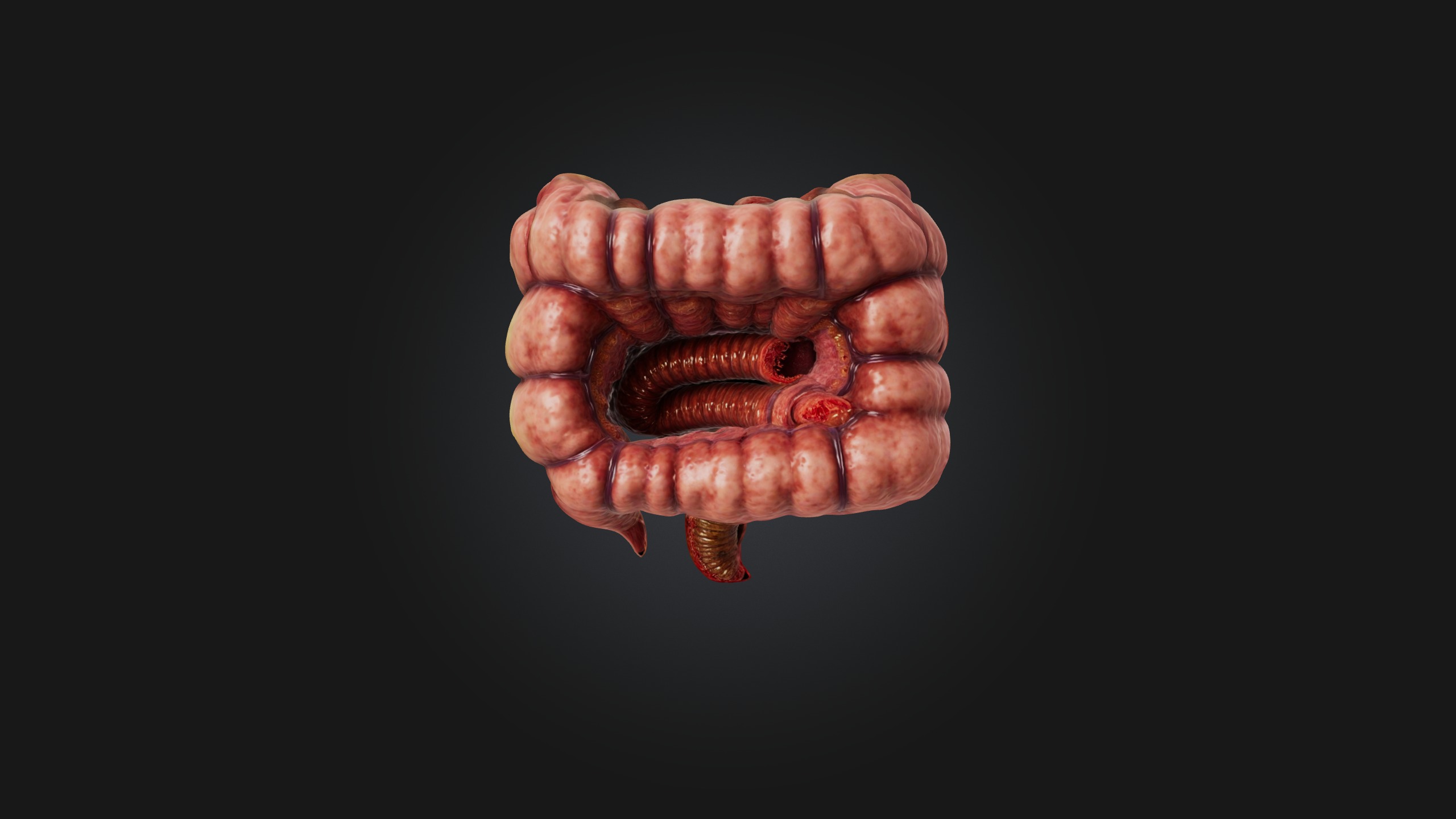 Infected Colon Low-poly 3D model_7