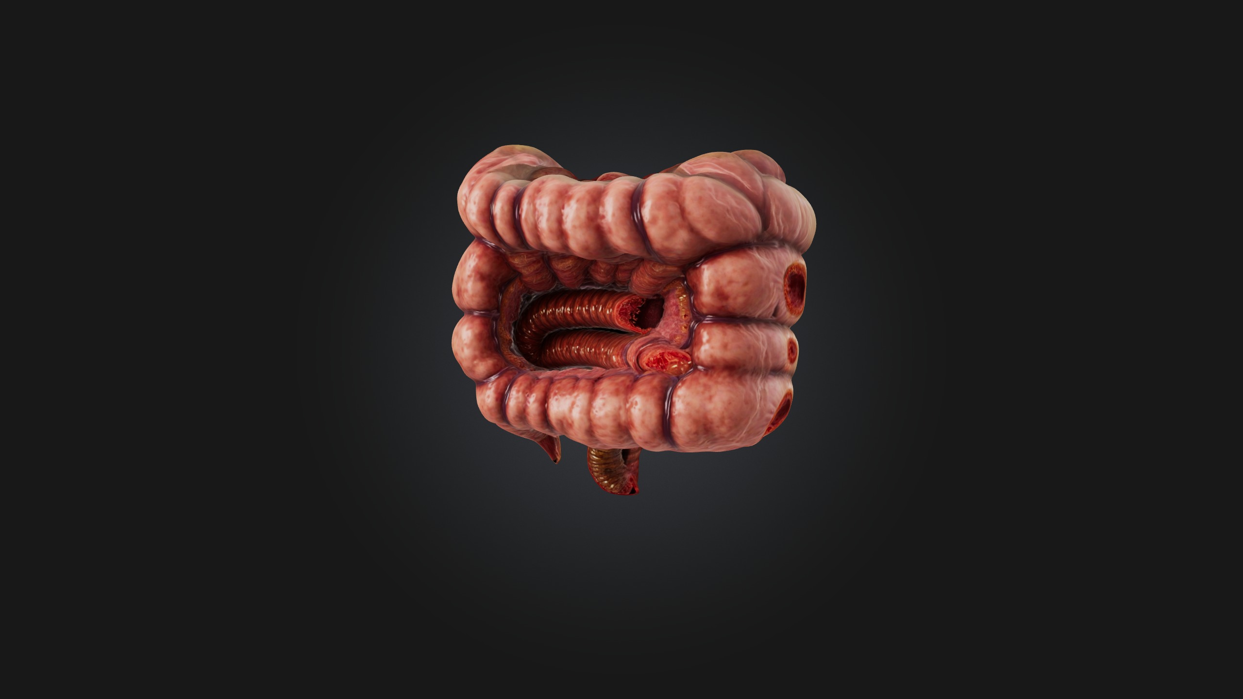 Infected Colon Low-poly 3D model_3