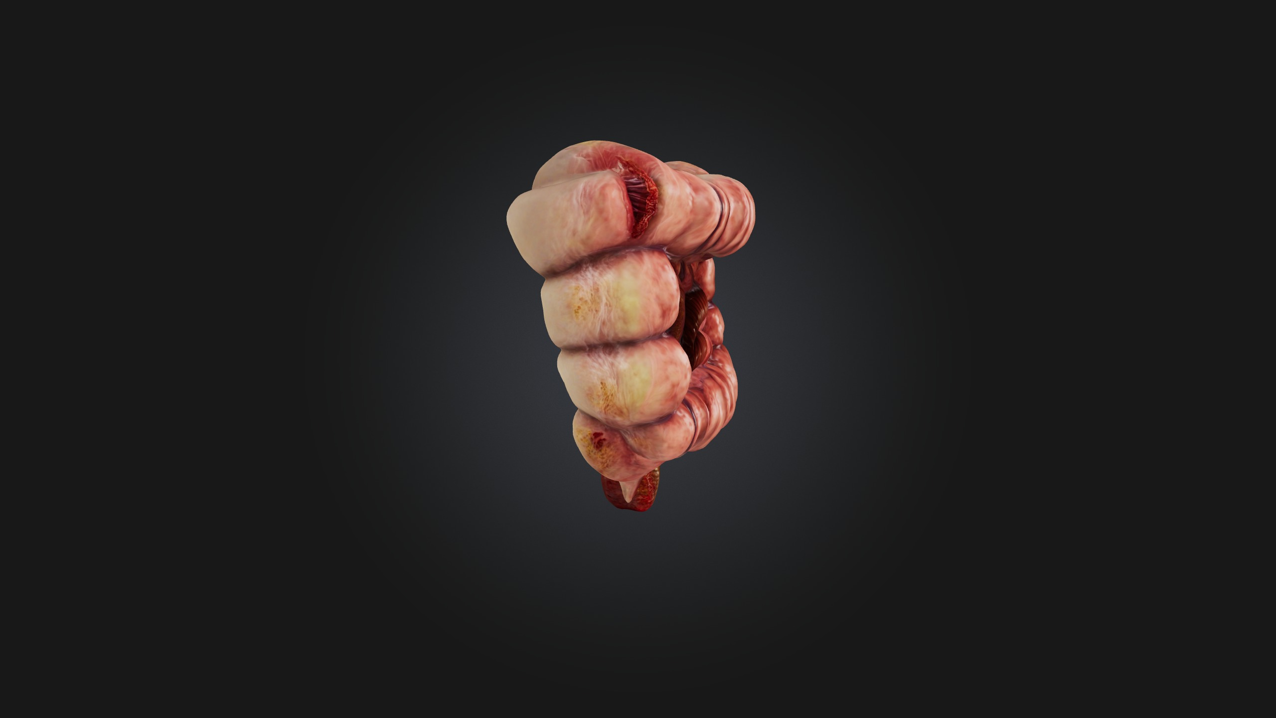 Infected Colon Low-poly 3D model_4