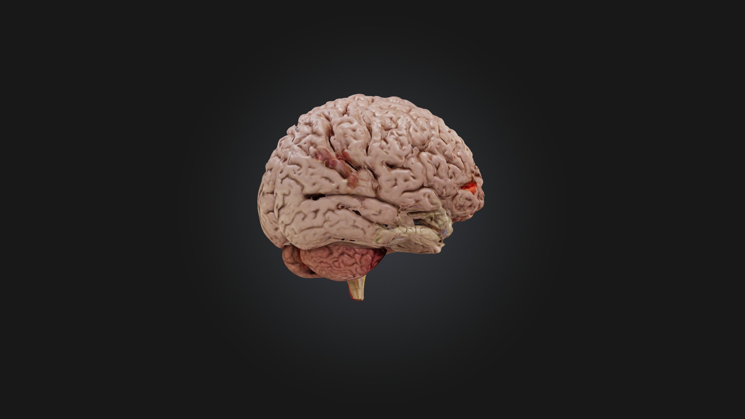 Diseased Brain Low-poly 3D model_6