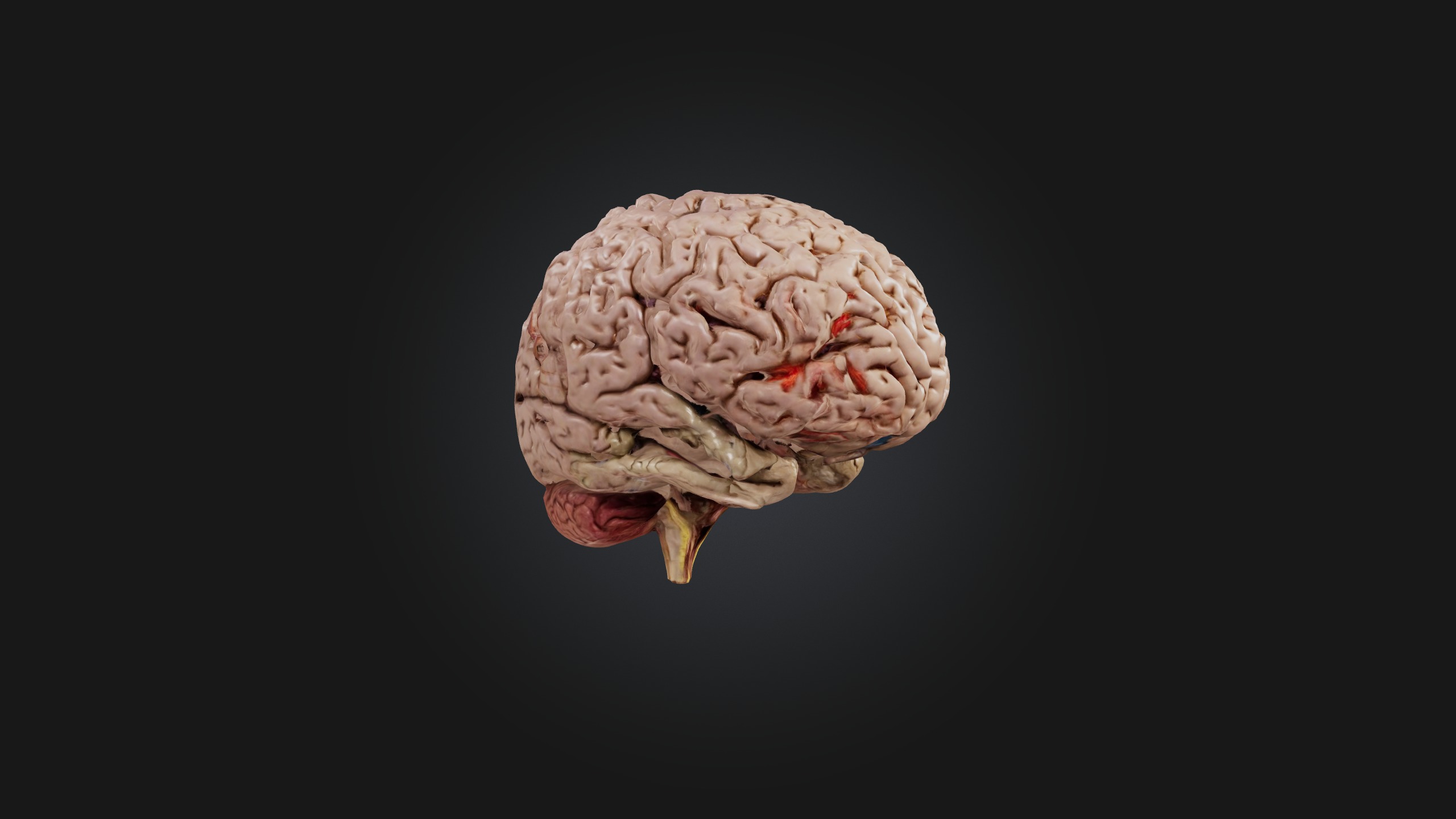 Diseased Brain Low-poly 3D model_5