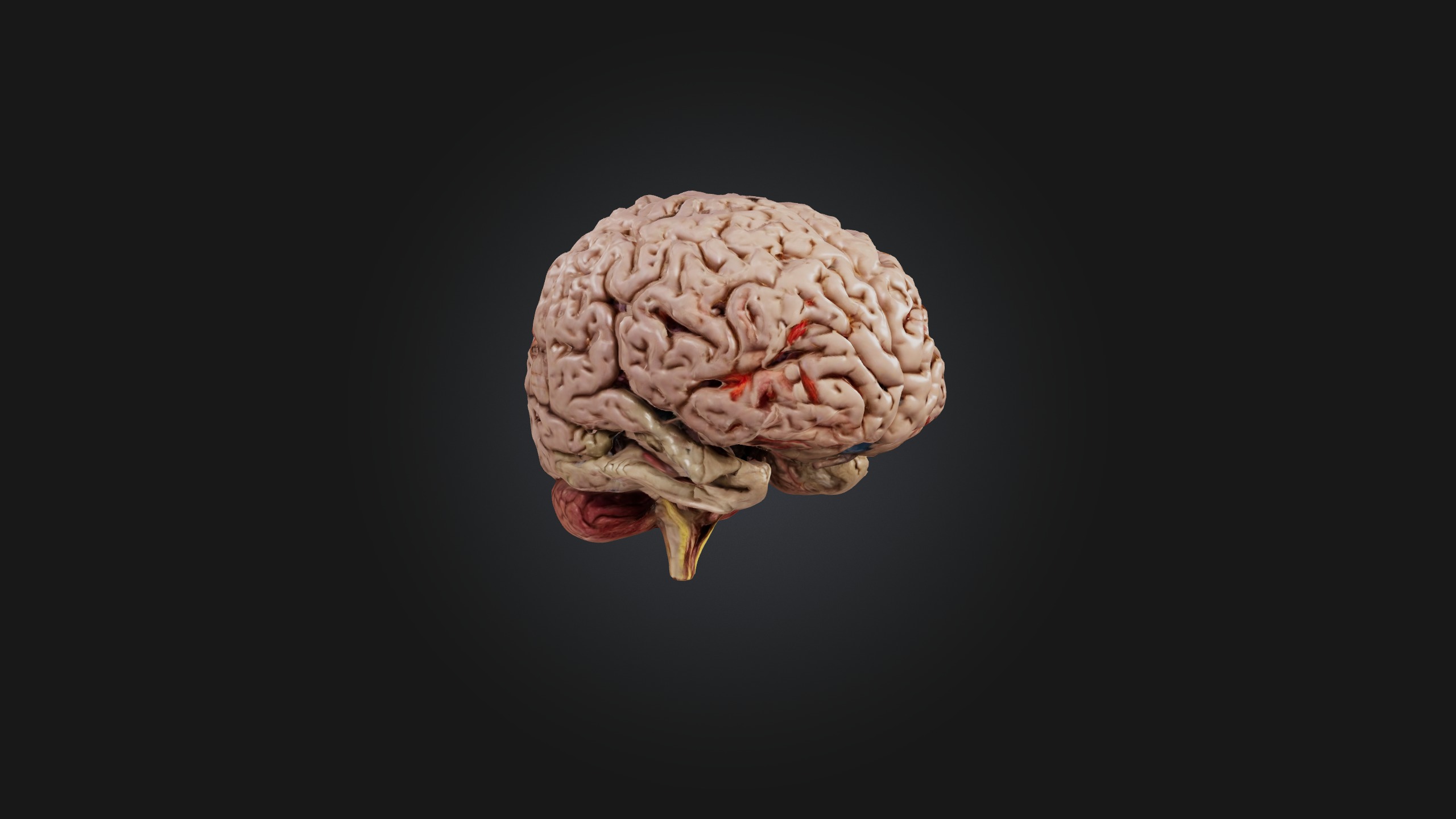 Diseased Brain Low-poly 3D model_4
