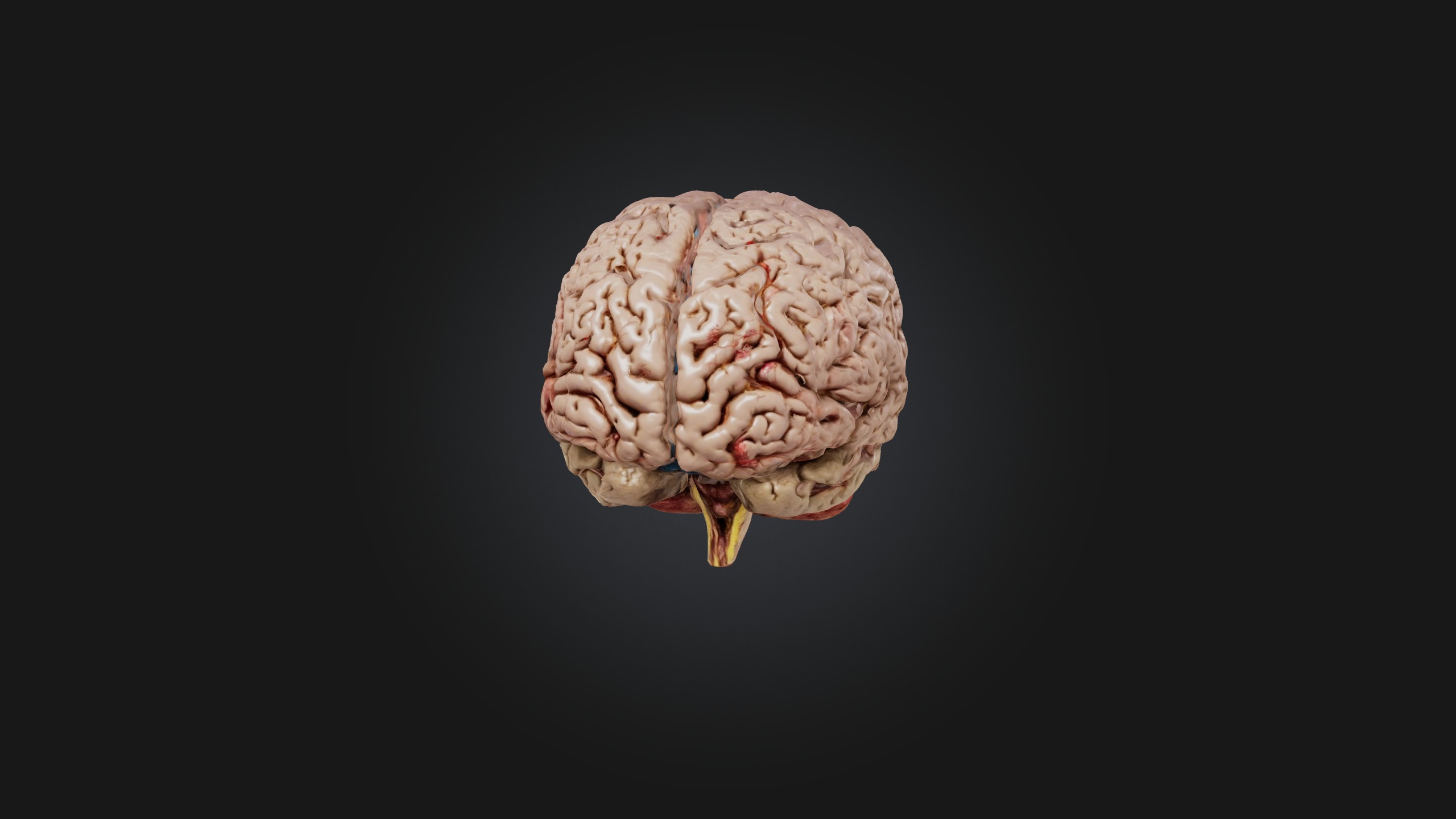 Diseased Brain Low-poly 3D model_1
