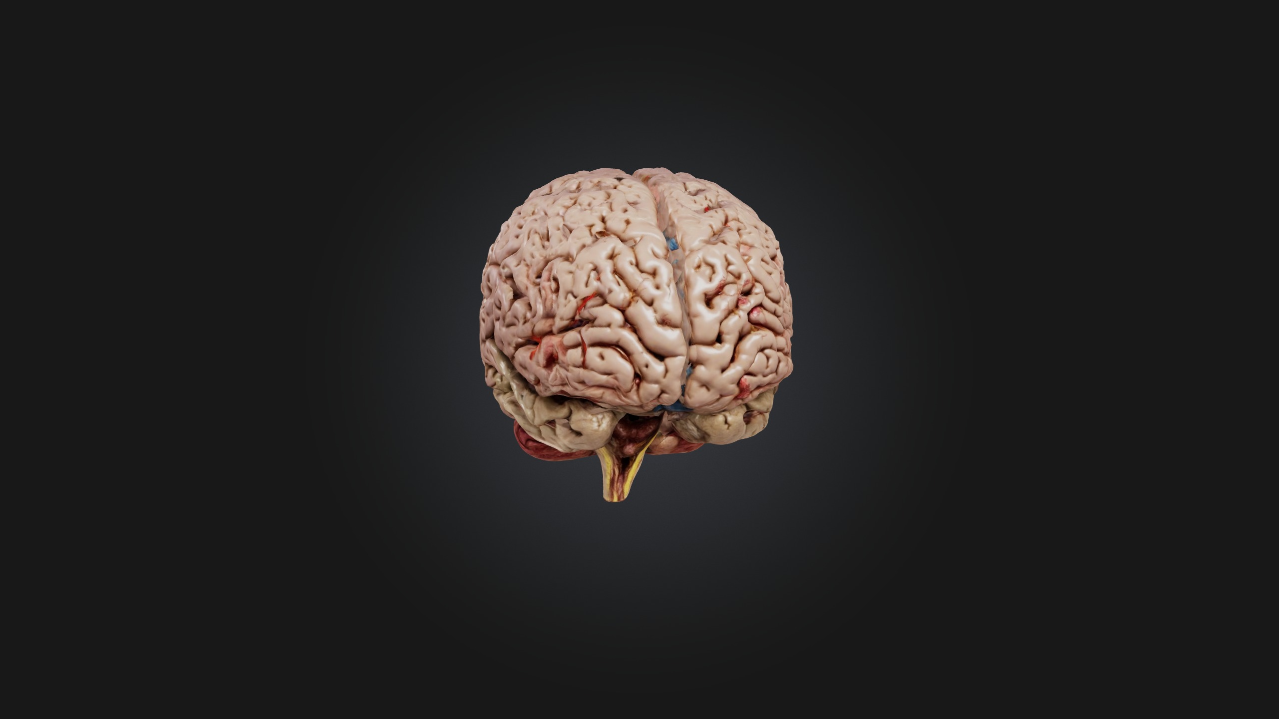 Diseased Brain Low-poly 3D model_3