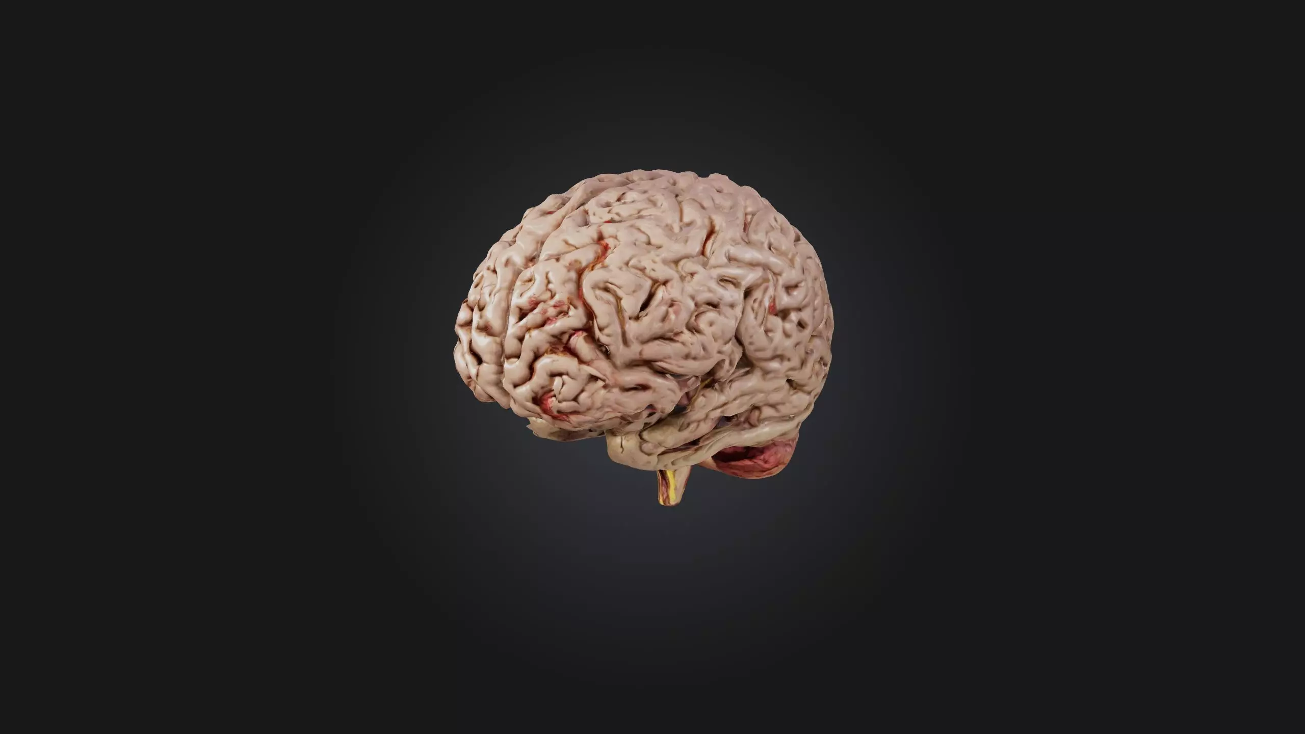 Diseased Brain Low-poly 3D model_0