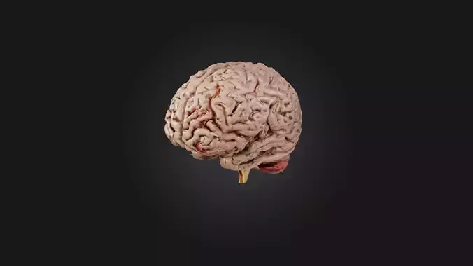 Diseased Brain Low-poly 3D model