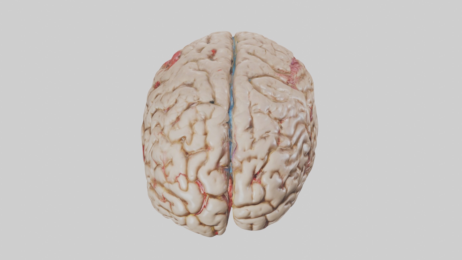 Infected Brain Model  3D model_10
