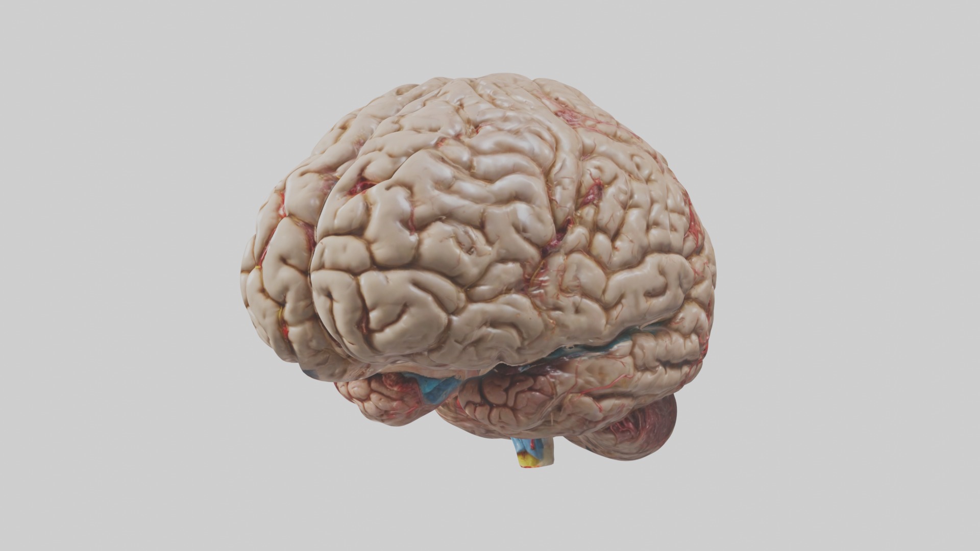 Infected Brain Model  3D model_1