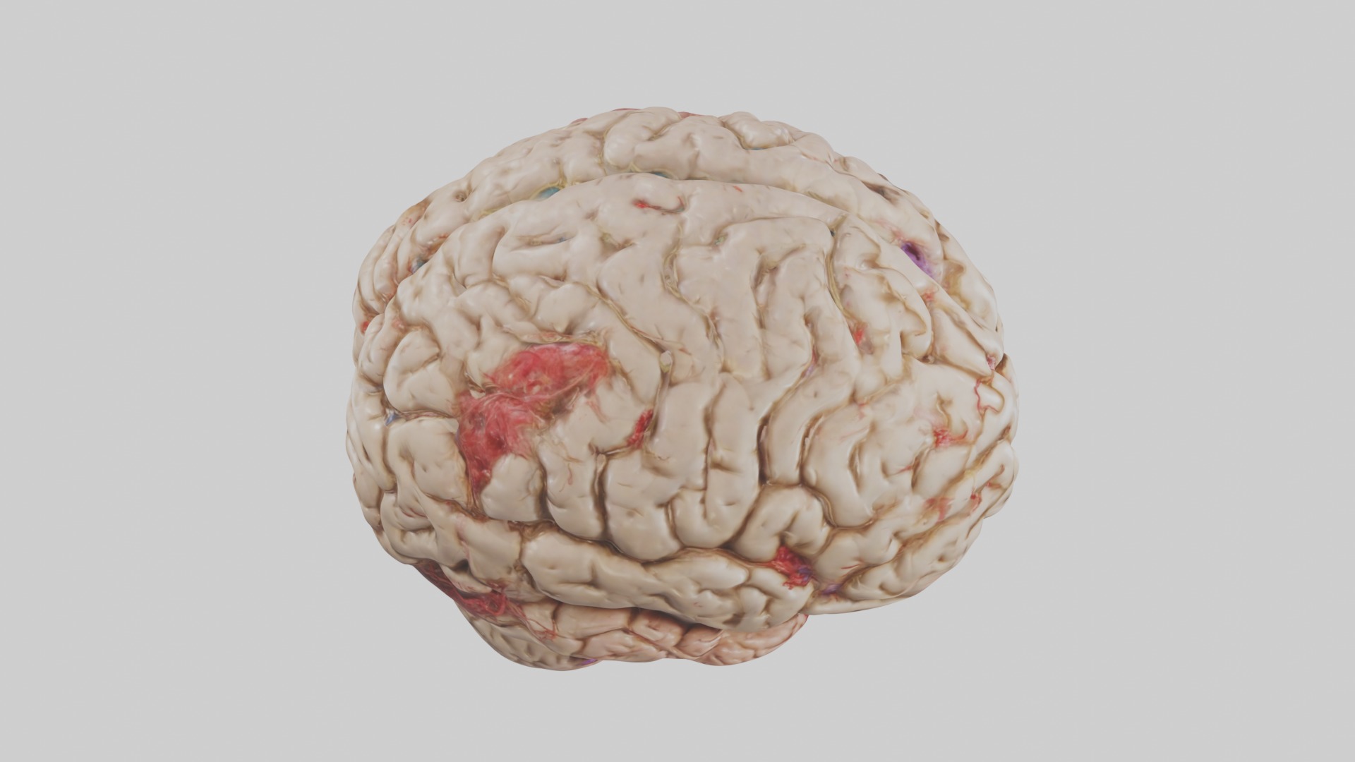 Infected Brain Model  3D model_12