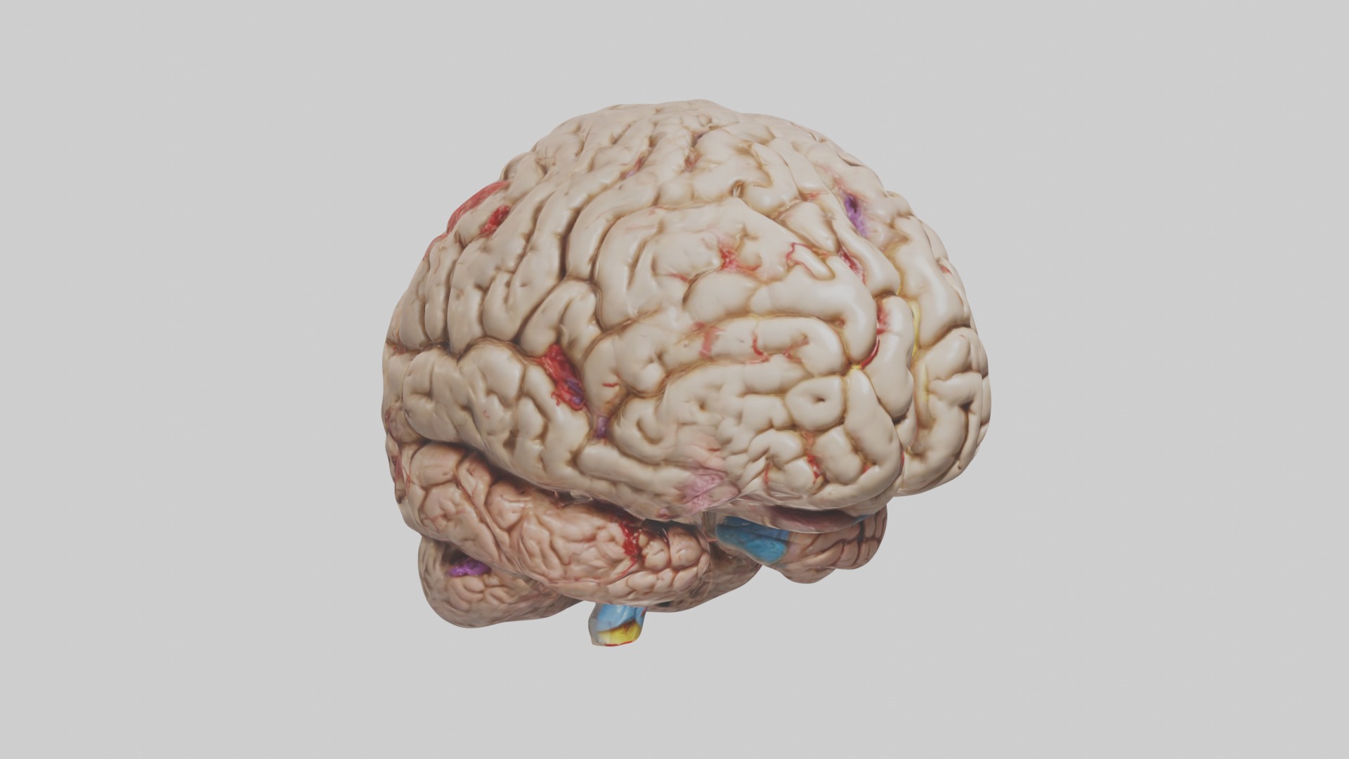Infected Brain Model  3D model_5