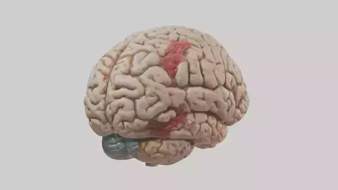 Infected Brain Model  3D model