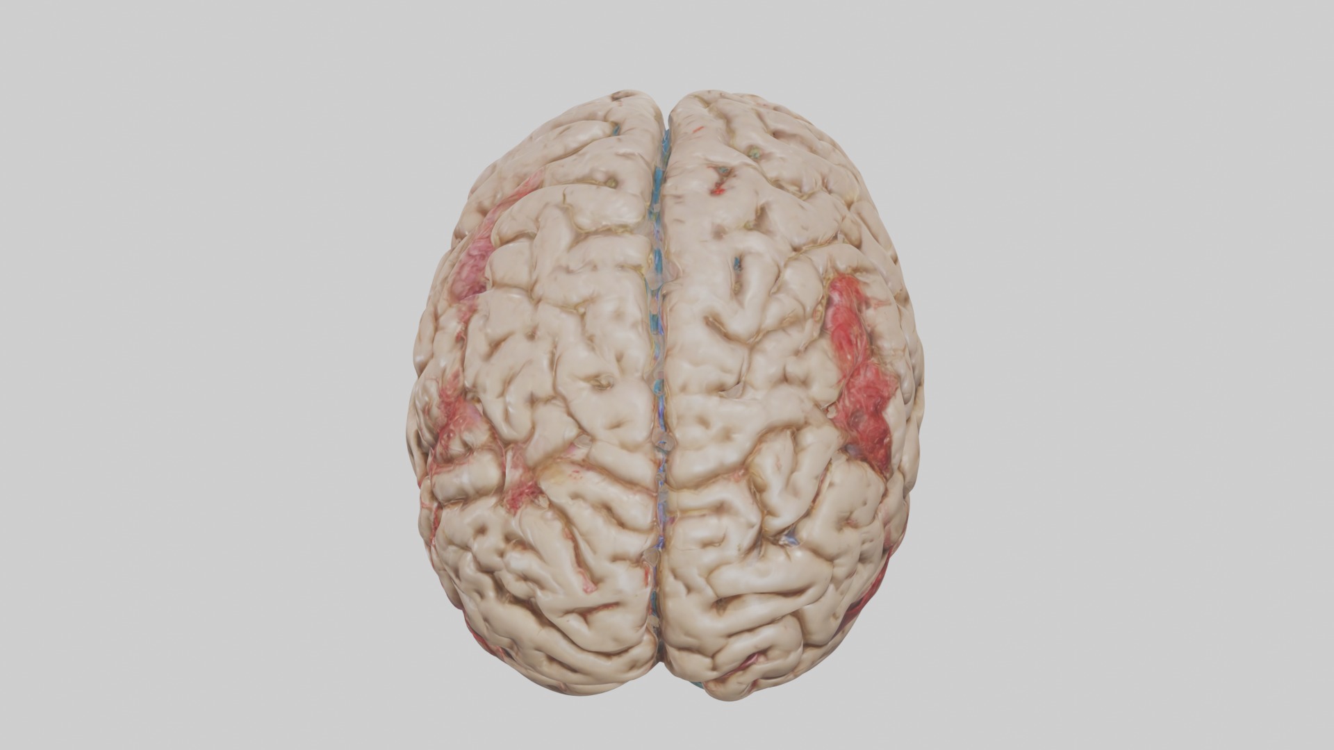 Infected Brain Model  3D model_9