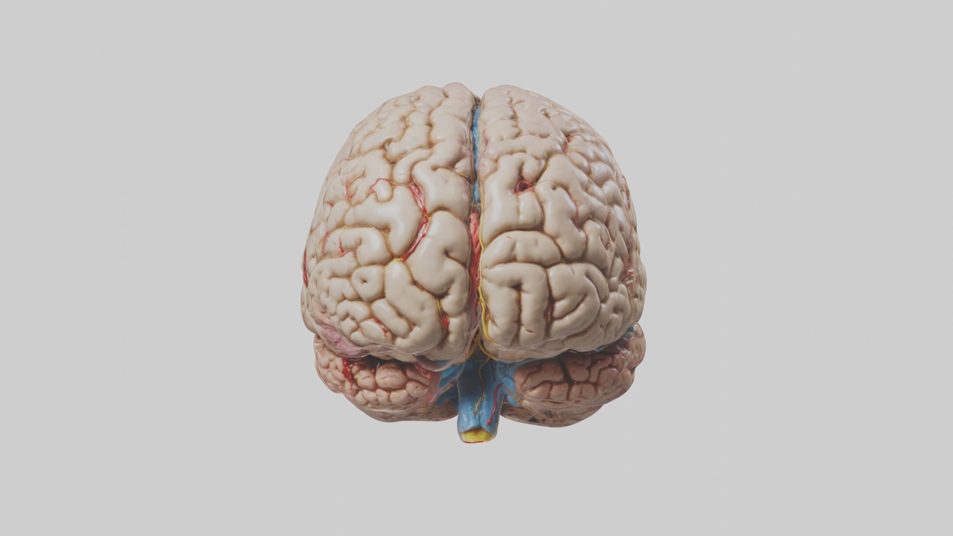 Infected Brain Model  3D model_4