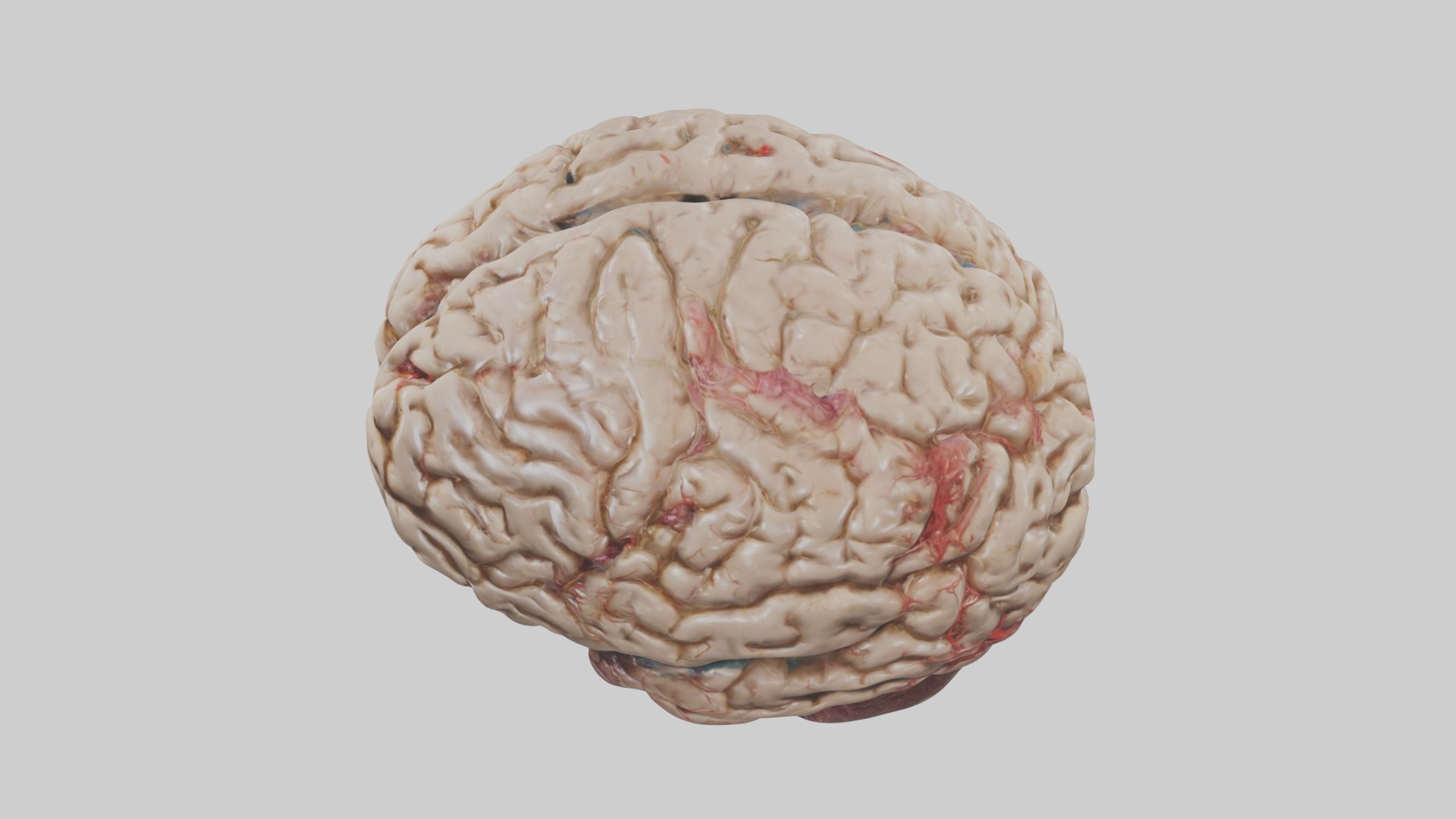 Infected Brain Model  3D model_11