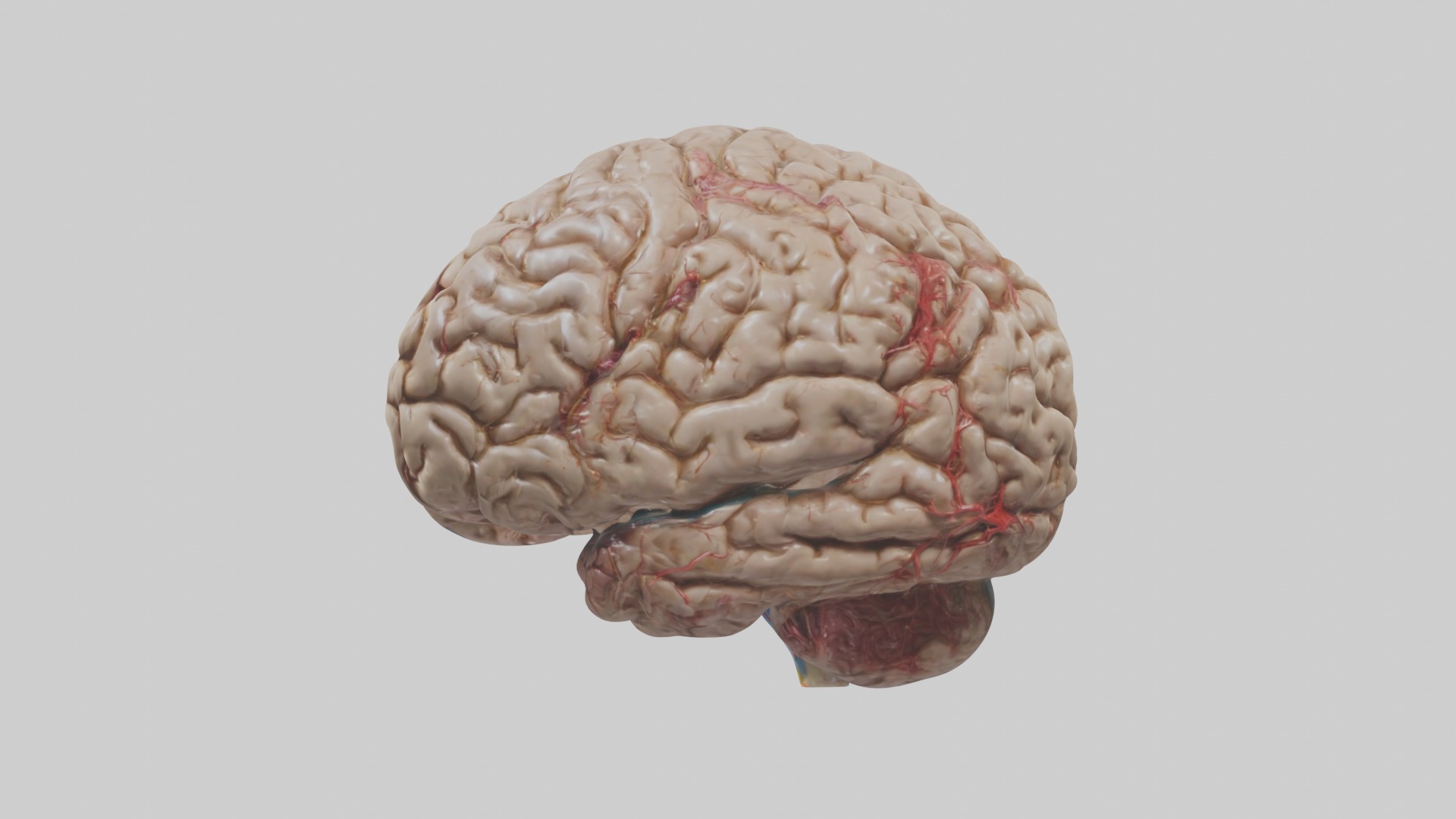 Infected Brain Model  3D model_6