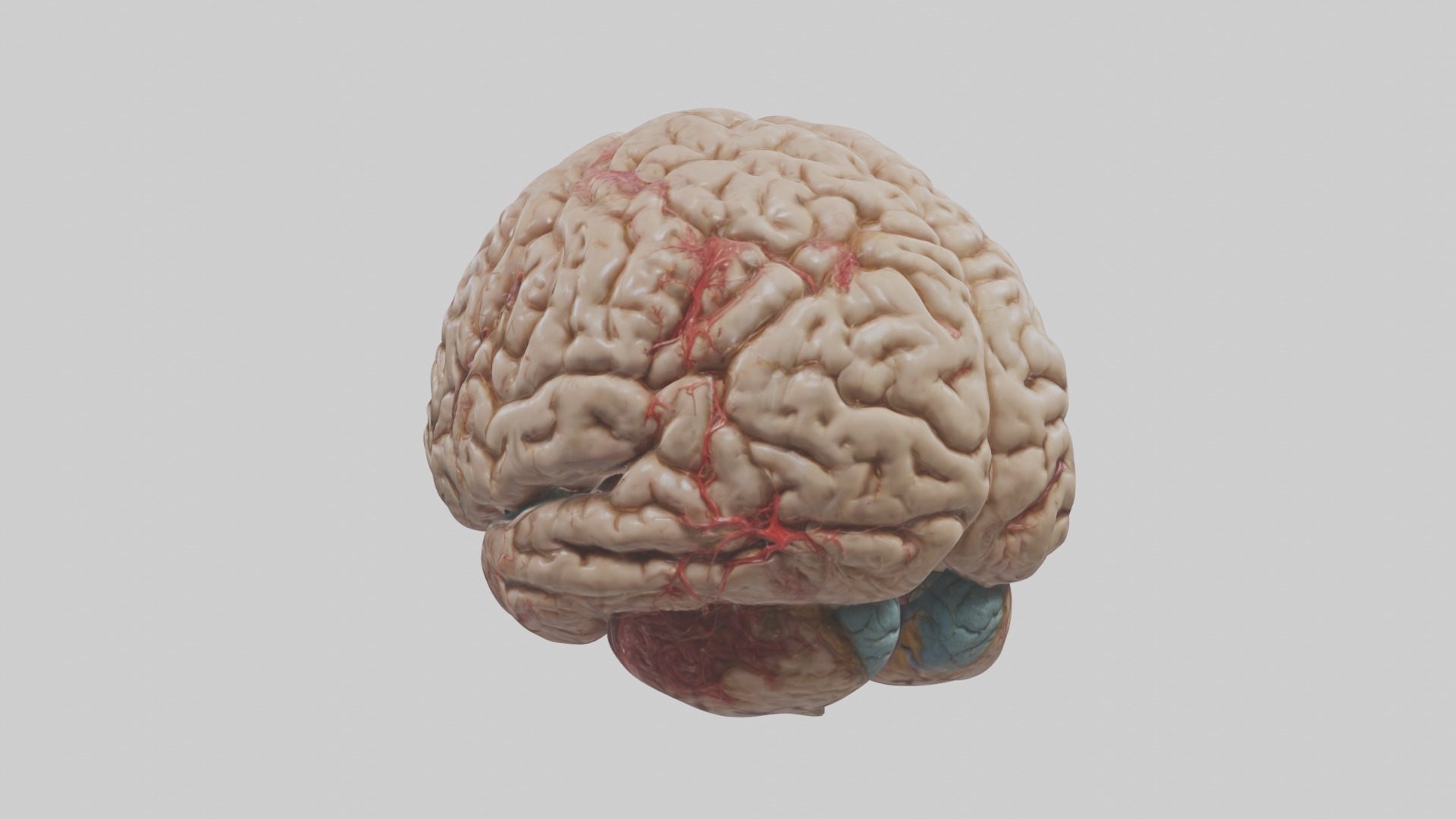 Infected Brain Model  3D model_3