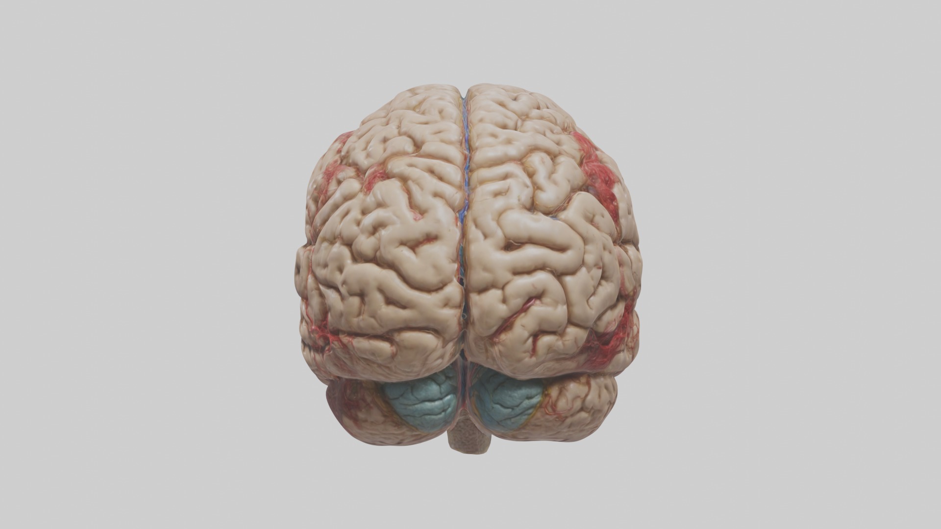 Infected Brain Model  3D model_2