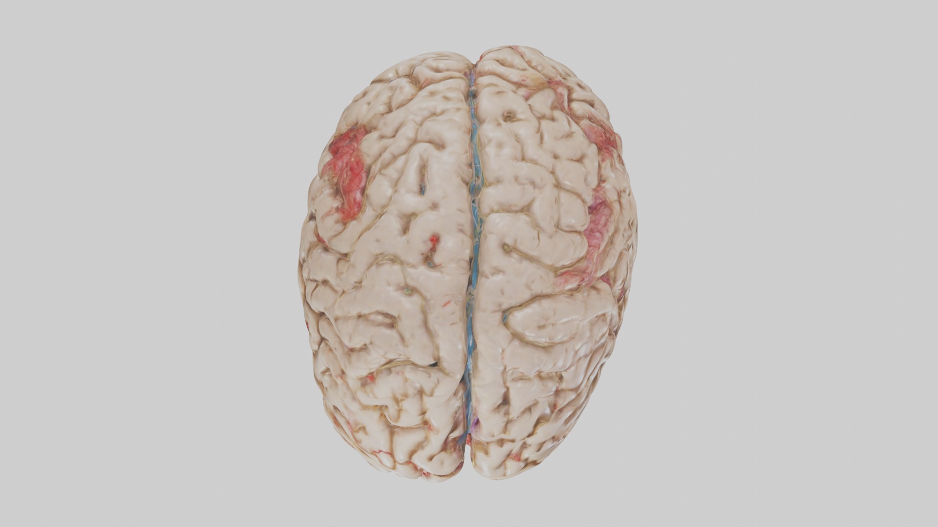 Infected Brain Model  3D model_8
