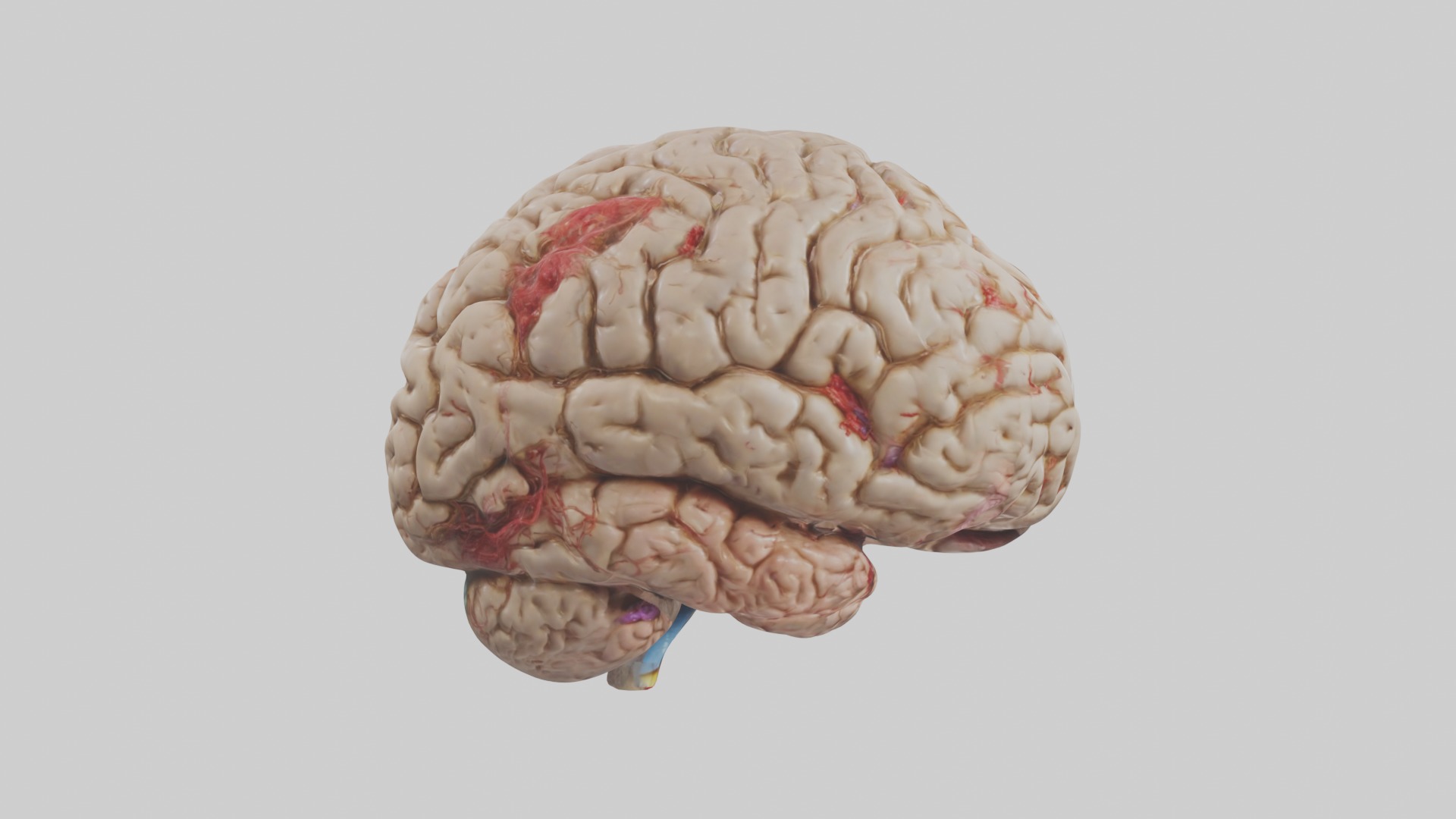 Infected Brain Model  3D model_7