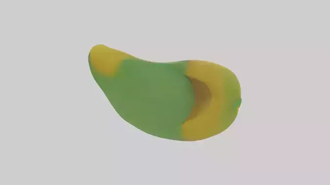 Gallbladder Model 1
