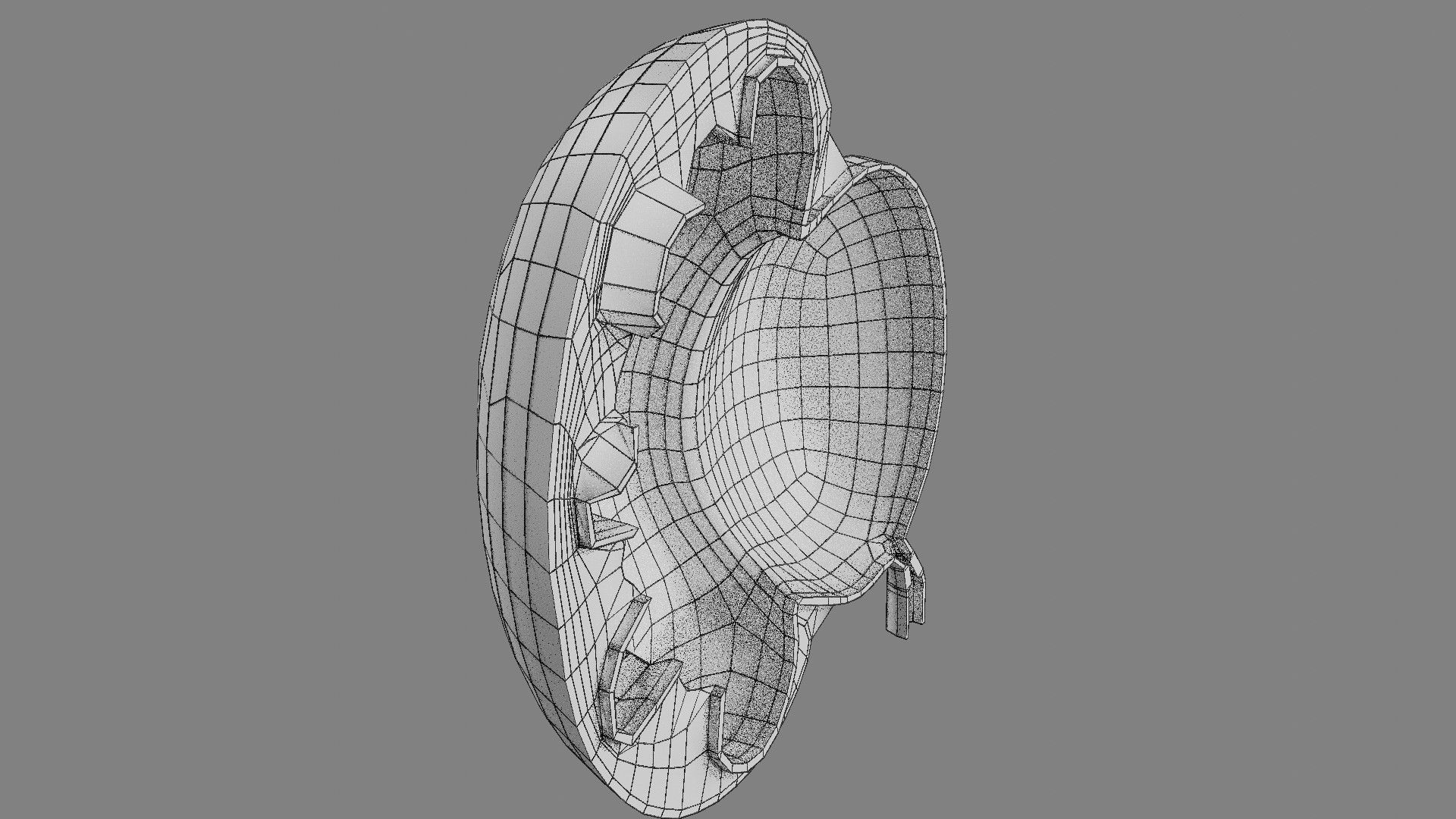 Hydronephrosis marked kidney renal Low-poly 3D model_20