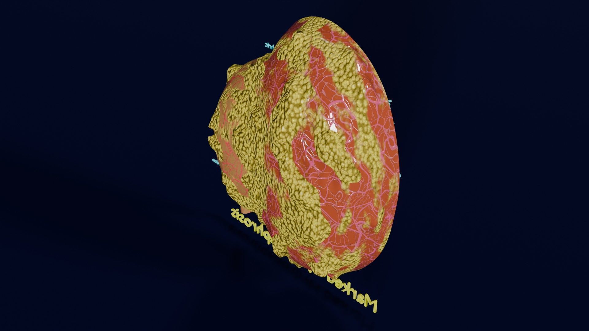 Hydronephrosis marked kidney renal Low-poly 3D model_37