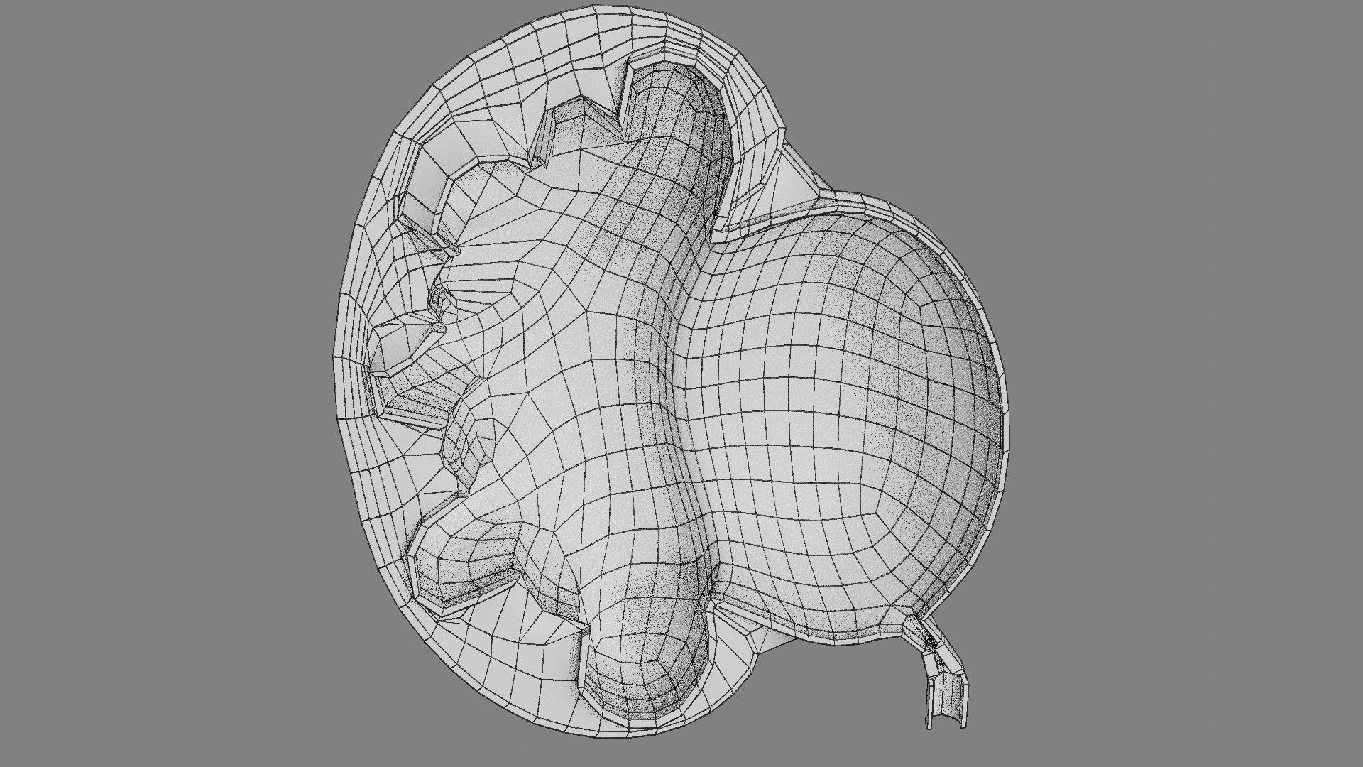 Hydronephrosis marked kidney renal Low-poly 3D model_17