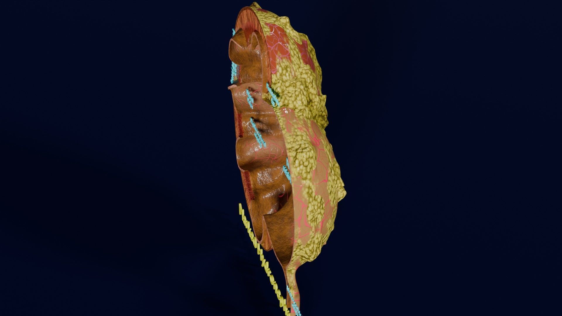 Hydronephrosis marked kidney renal Low-poly 3D model_44