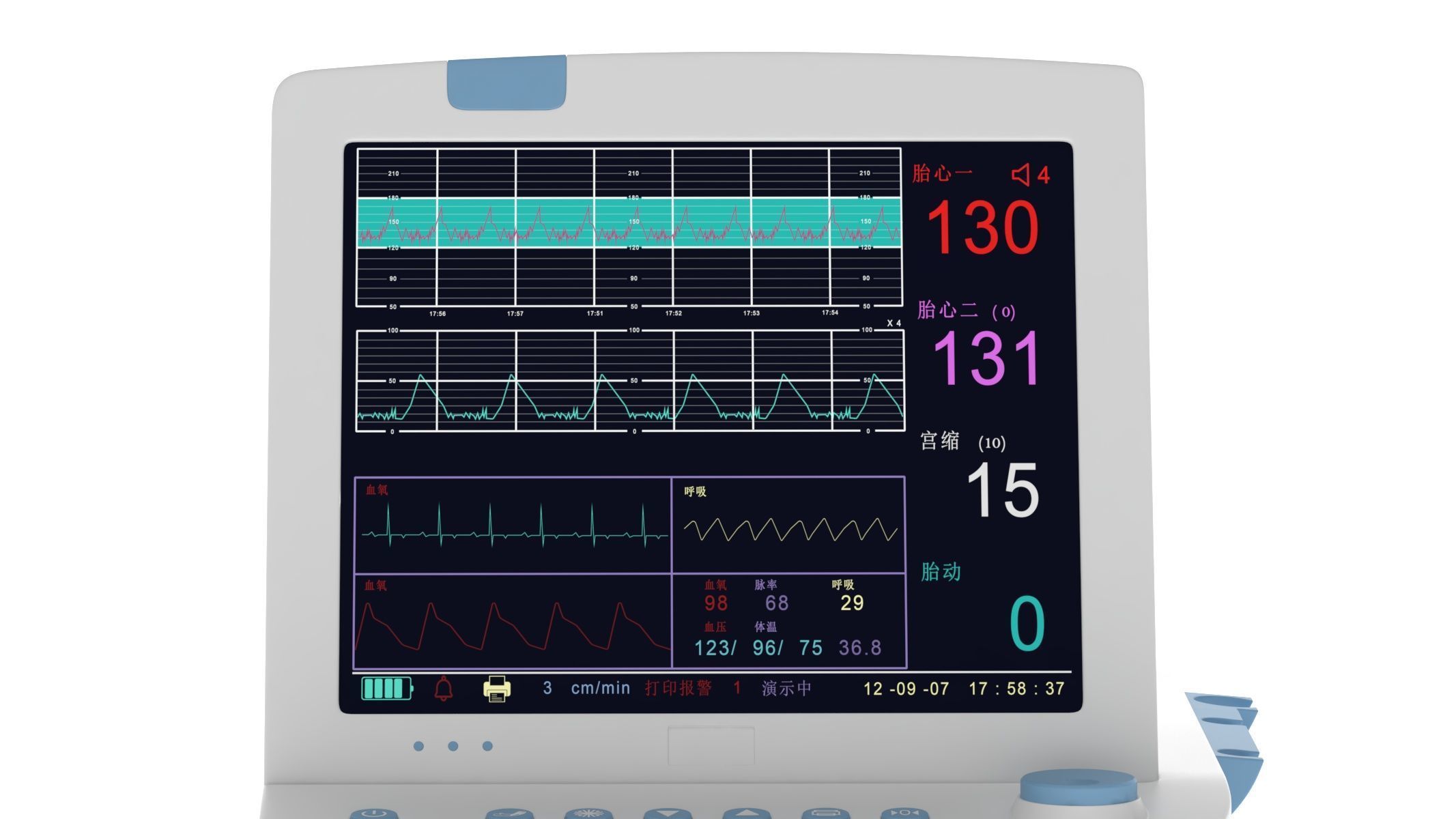 Medical Maternal Monitor 3D model_11