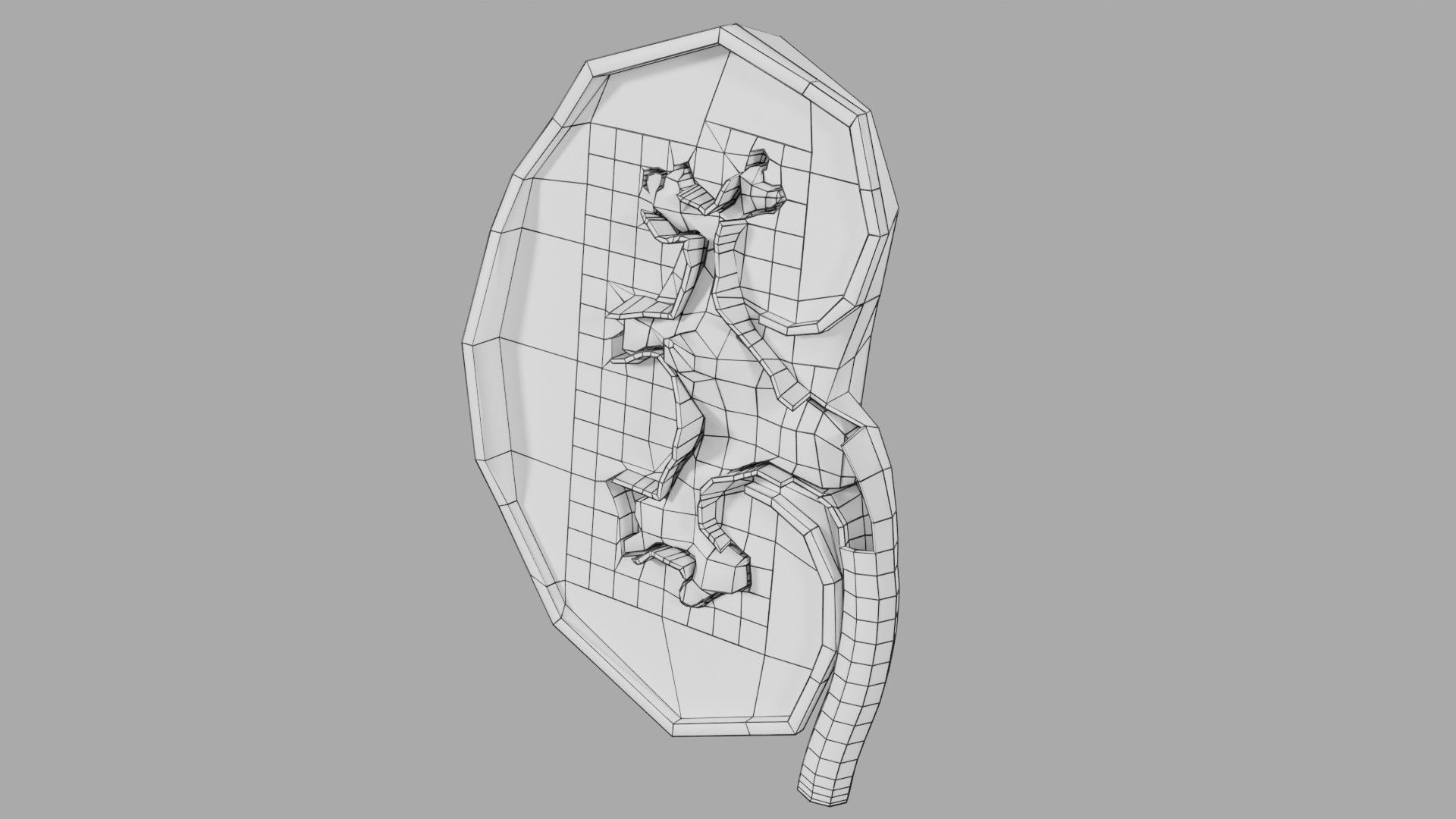 Kidney stone nephrolithiasis Staghorn calculus Low-poly 3D model_20
