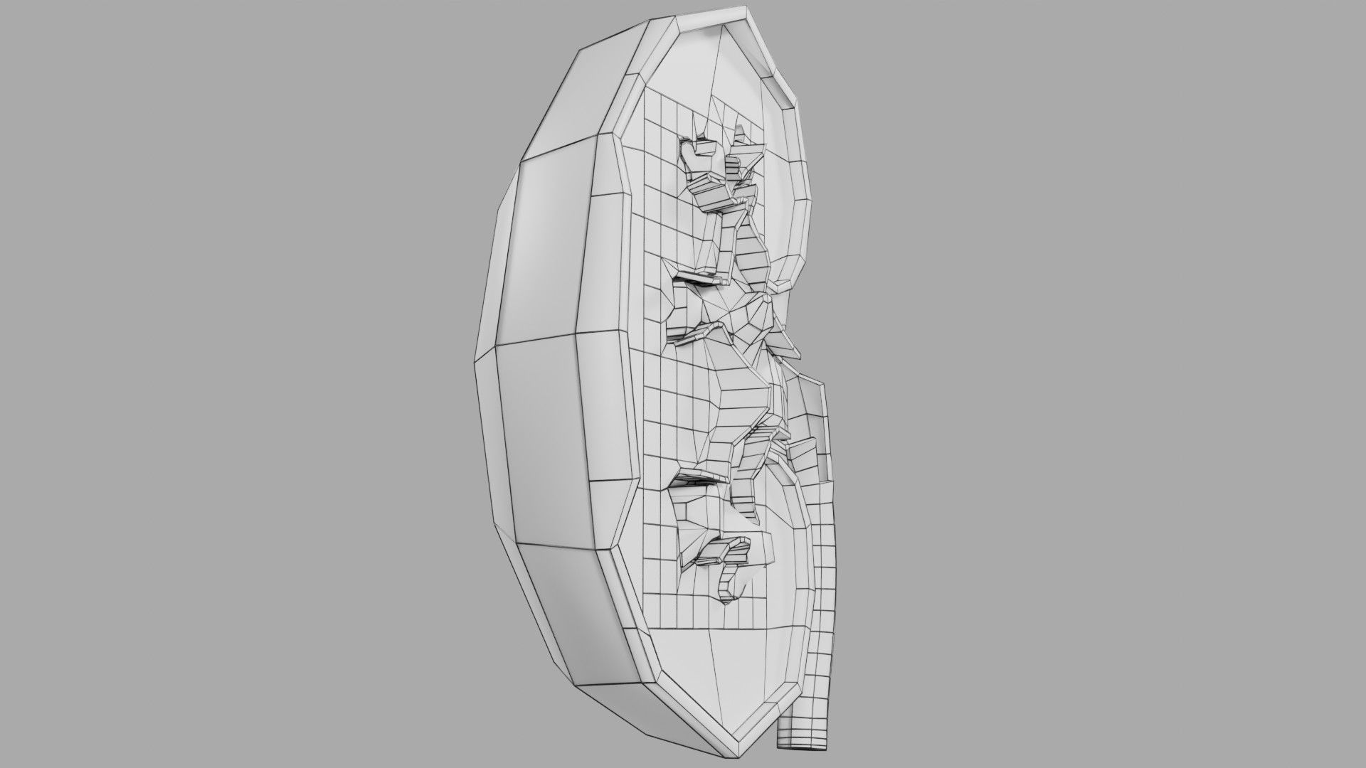 Kidney stone nephrolithiasis Staghorn calculus Low-poly 3D model_22