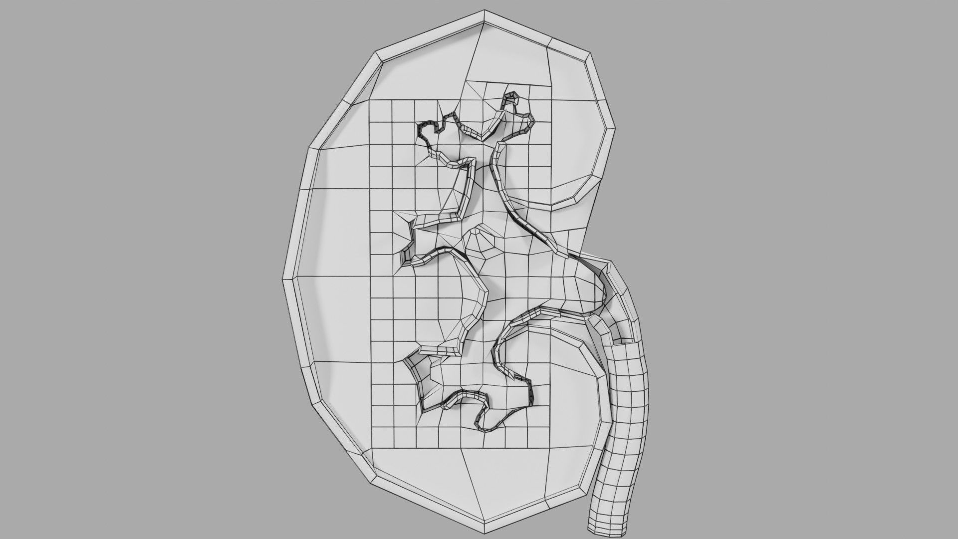 Kidney stone nephrolithiasis Staghorn calculus Low-poly 3D model_21