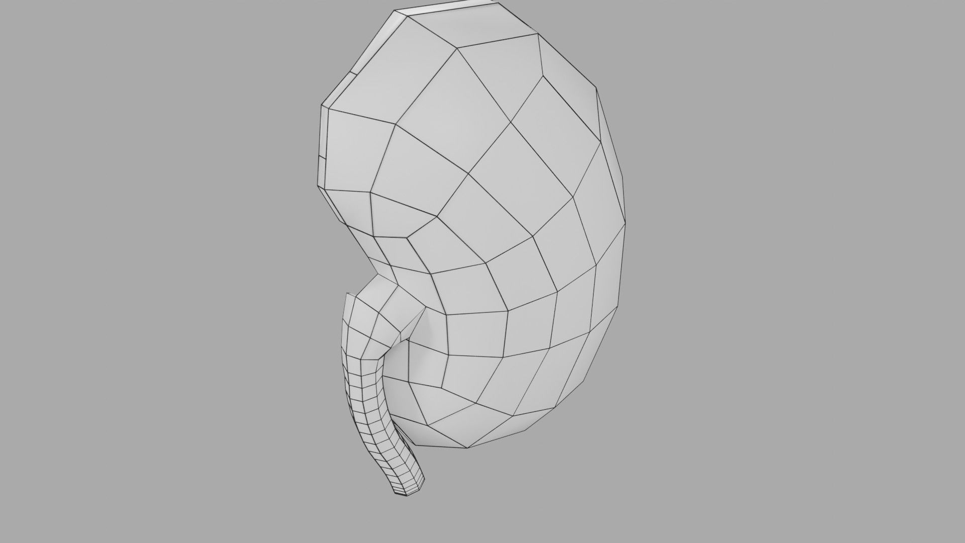 Kidney stone nephrolithiasis Staghorn calculus Low-poly 3D model_29